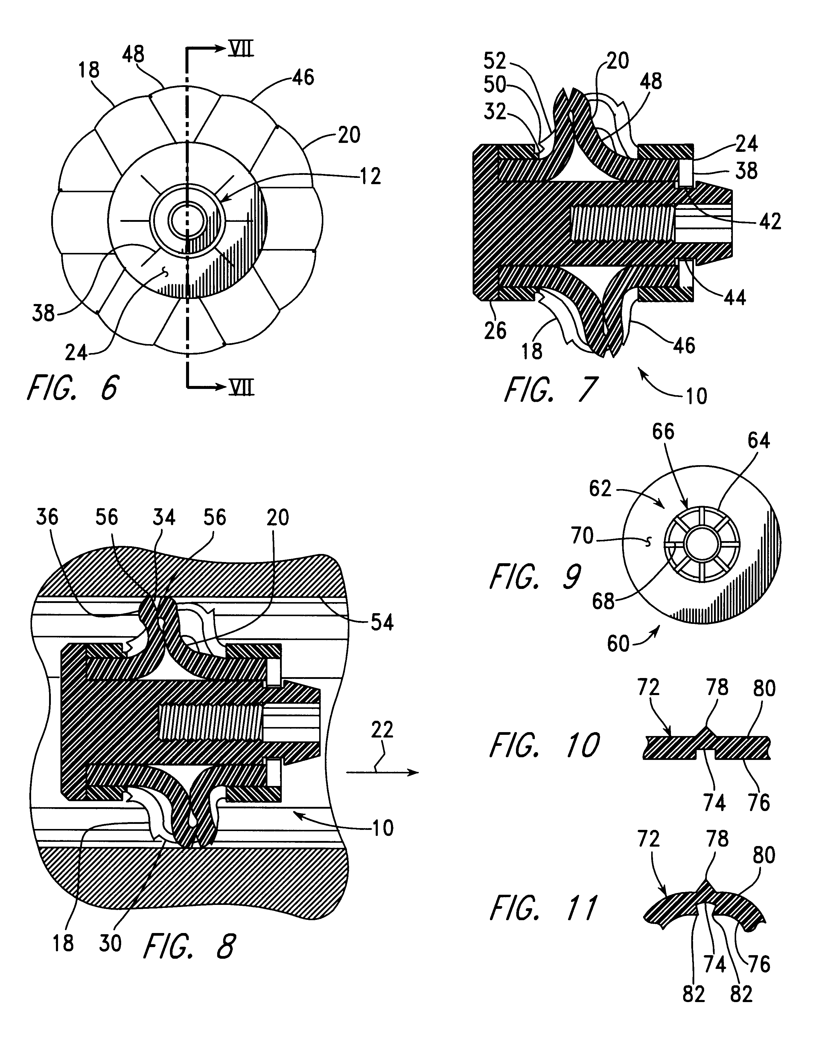 Device and method for plugging a bone channel with an expandable medullary plug