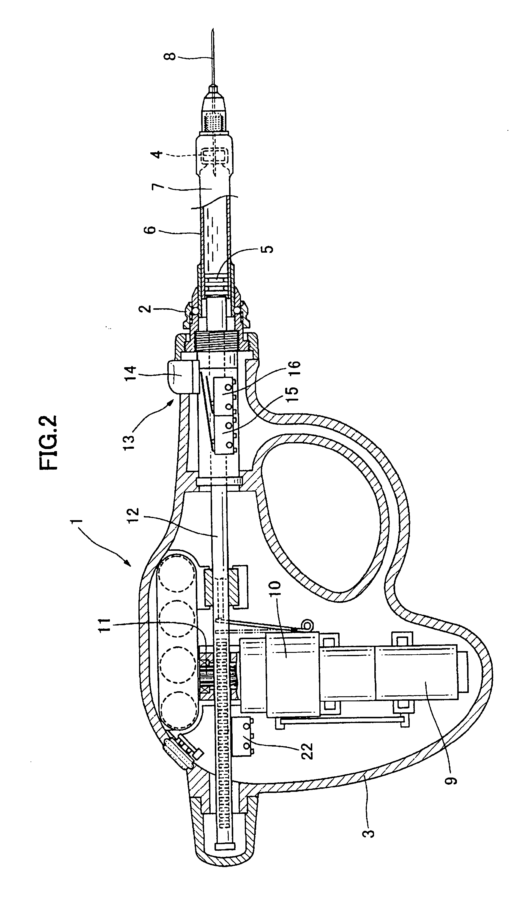 Method and apparatus for controlling the injection rate of a drug solution in a cartridge type motor-driven dental injection syringe