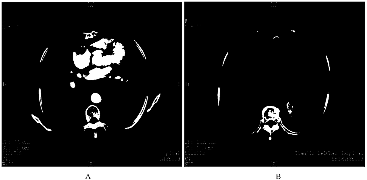 Antigenic peptide chain group for treating tumor and application thereof in medicine