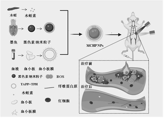Bionic nano-particles with antithrombotic function as well as preparation method and application of bionic nano-particles