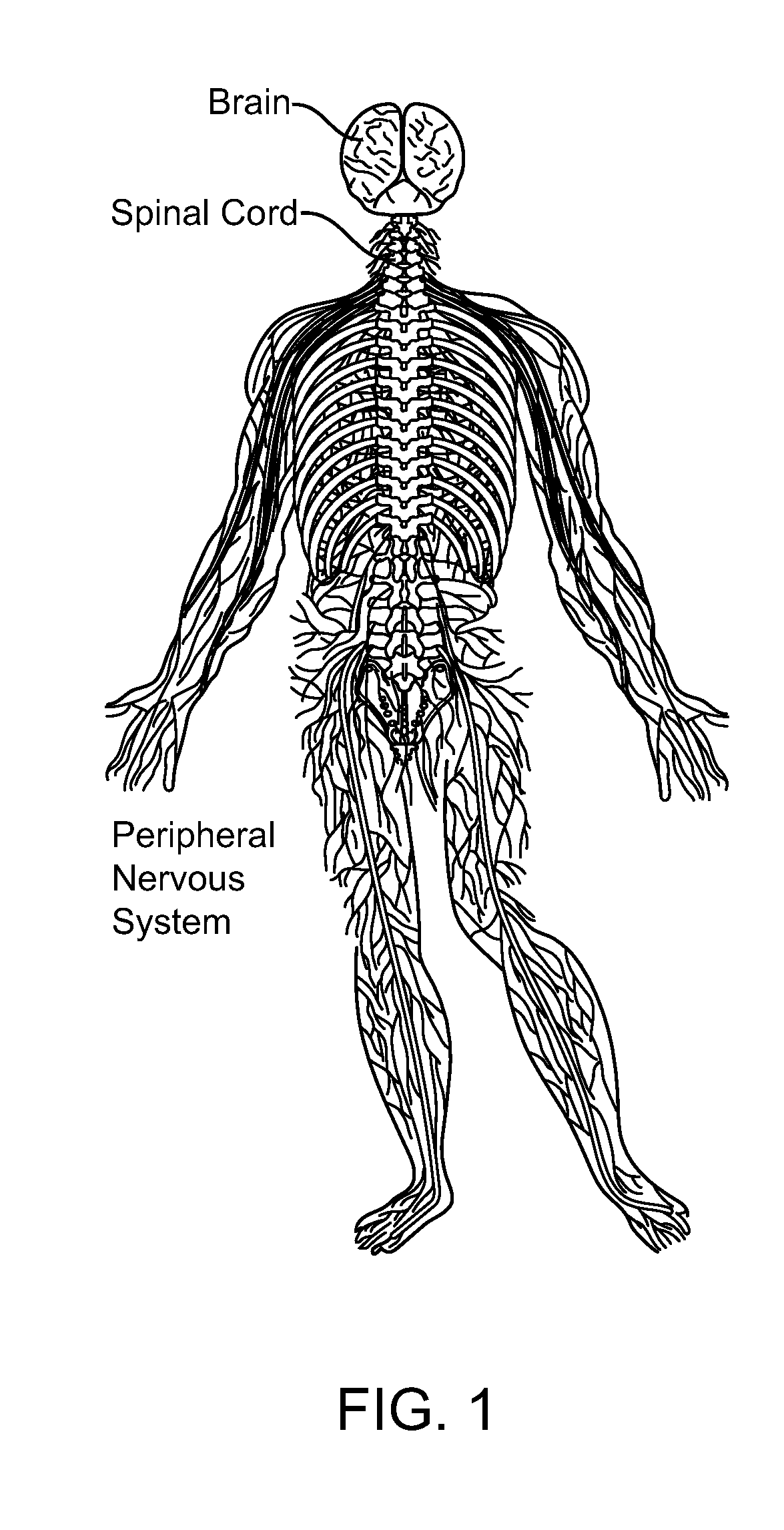 Systems and methods for implantable leadless nerve stimulation