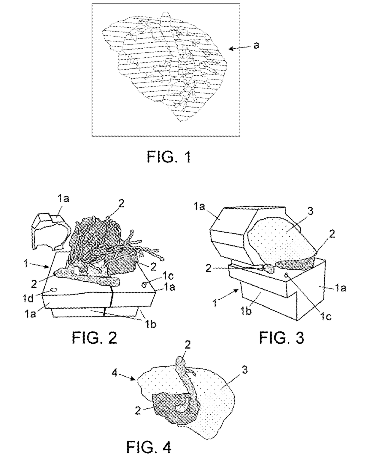 Method for producing anatomical models and models obtained
