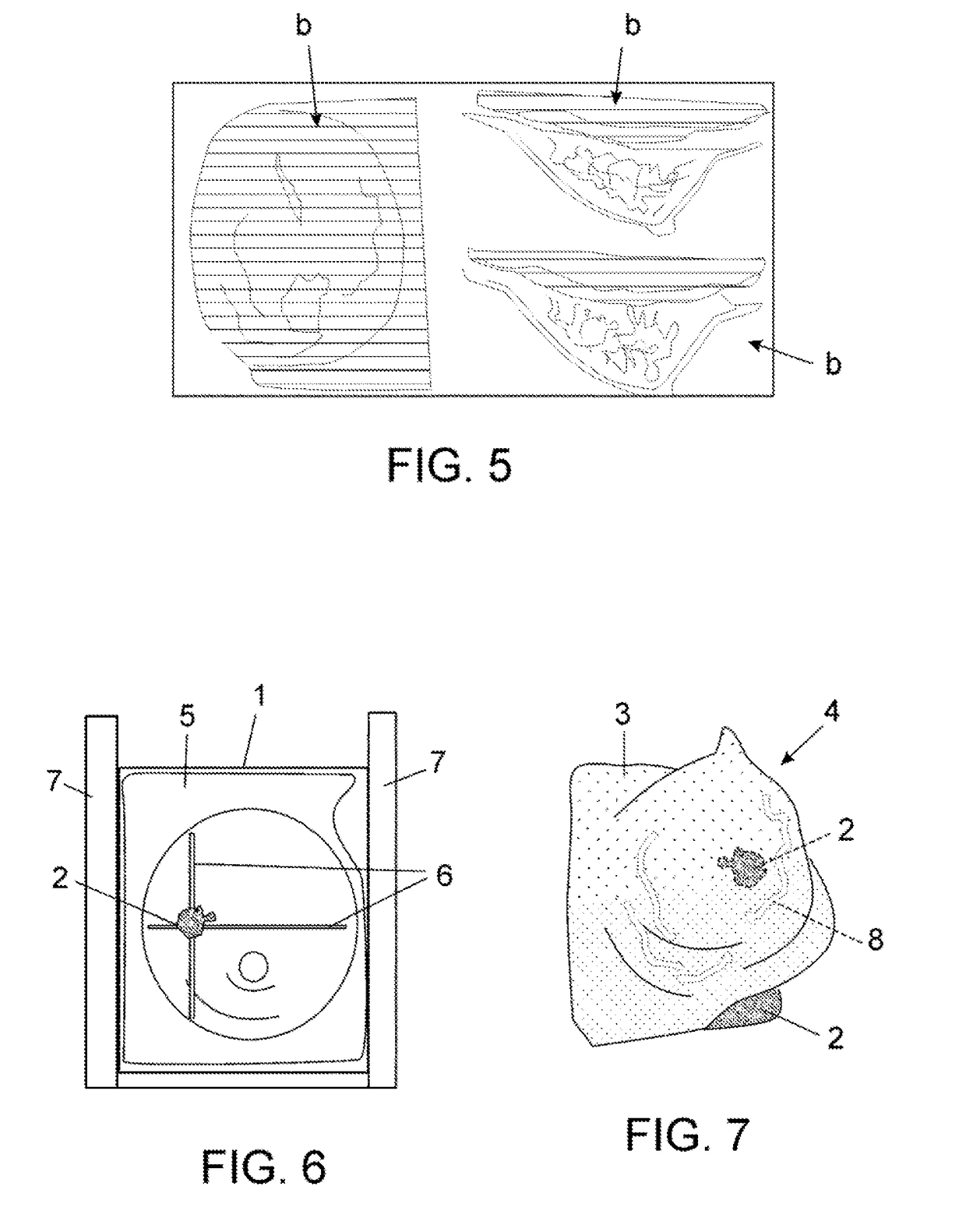 Method for producing anatomical models and models obtained