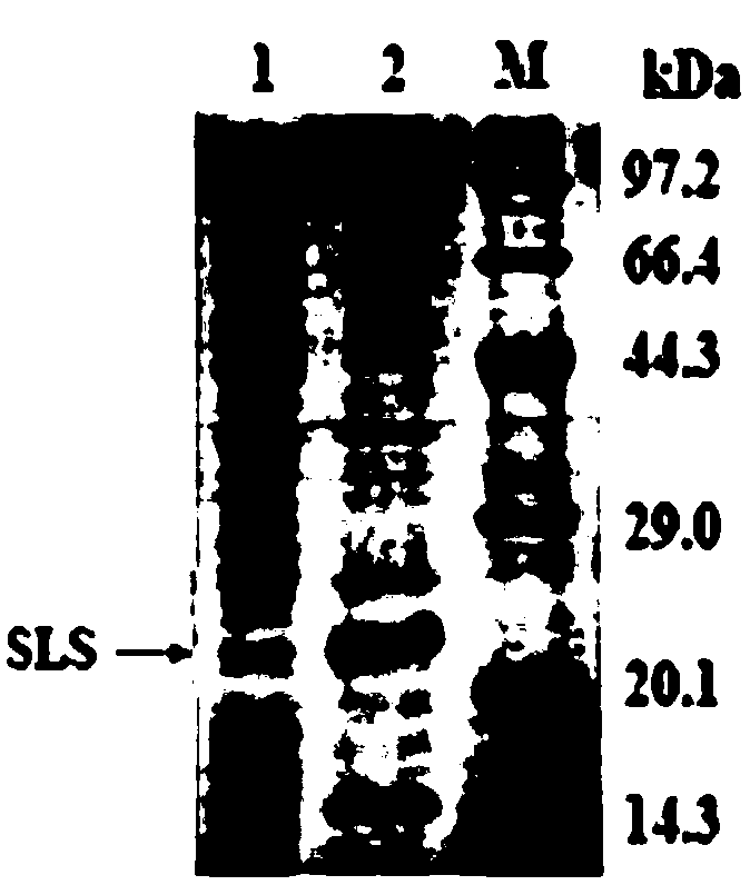 STa-LTB-STb fusion protein of enterotoxin of escherichia coli and encoding gene and application thereof