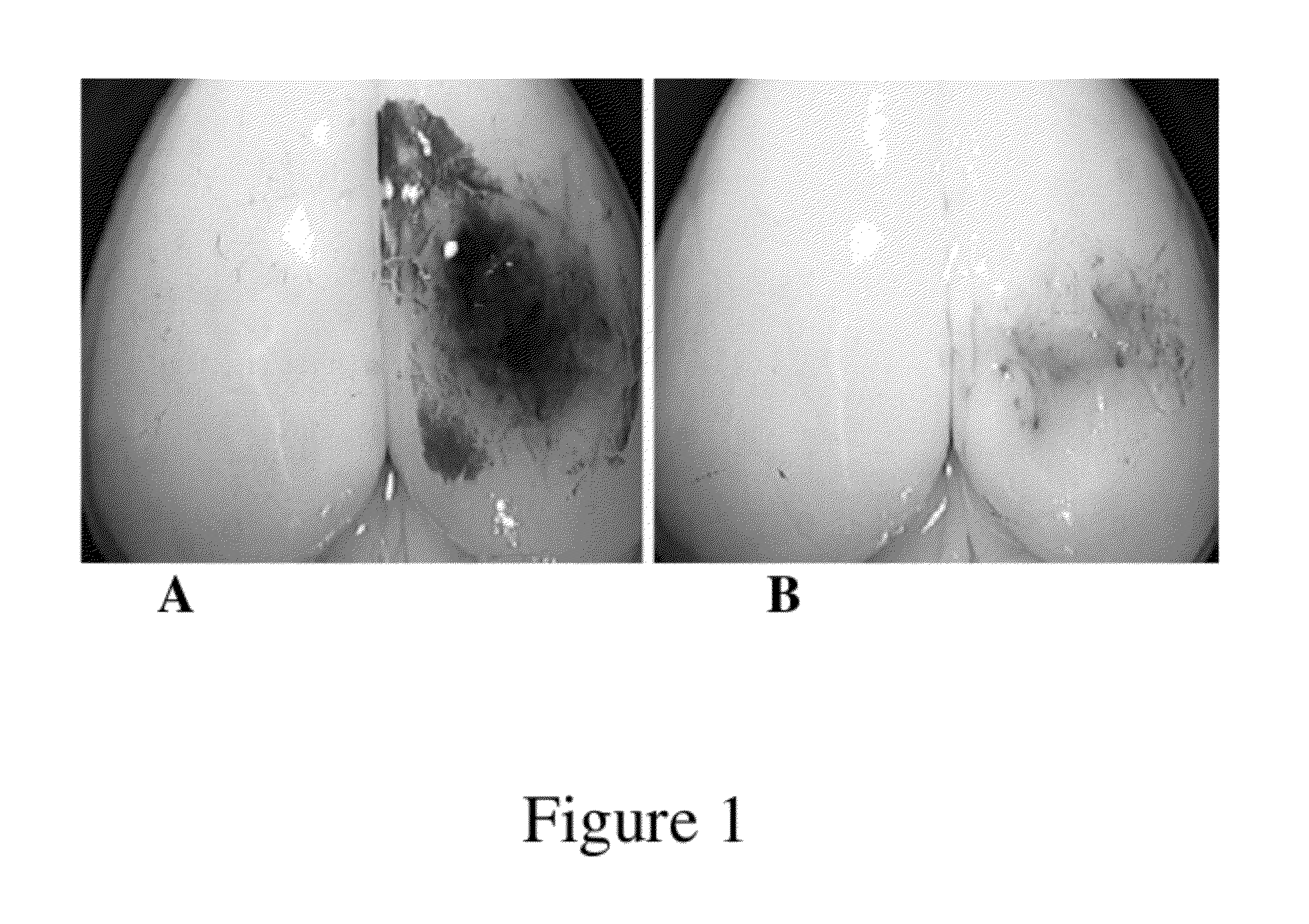 Methods of increasing neuronal differentiation using antibodies to lysophosphatidic acid