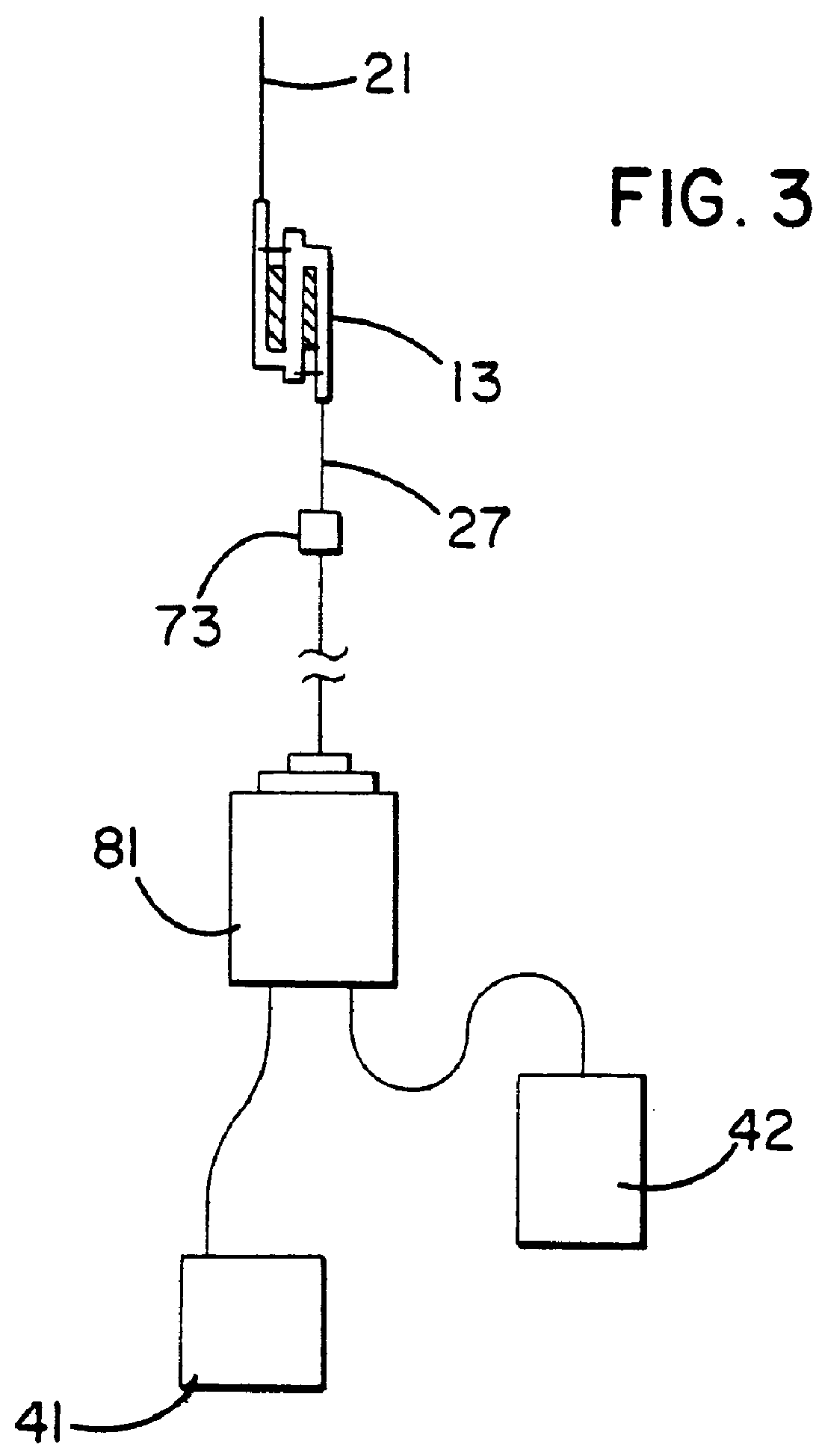 Automated system and method for processing biological fluid
