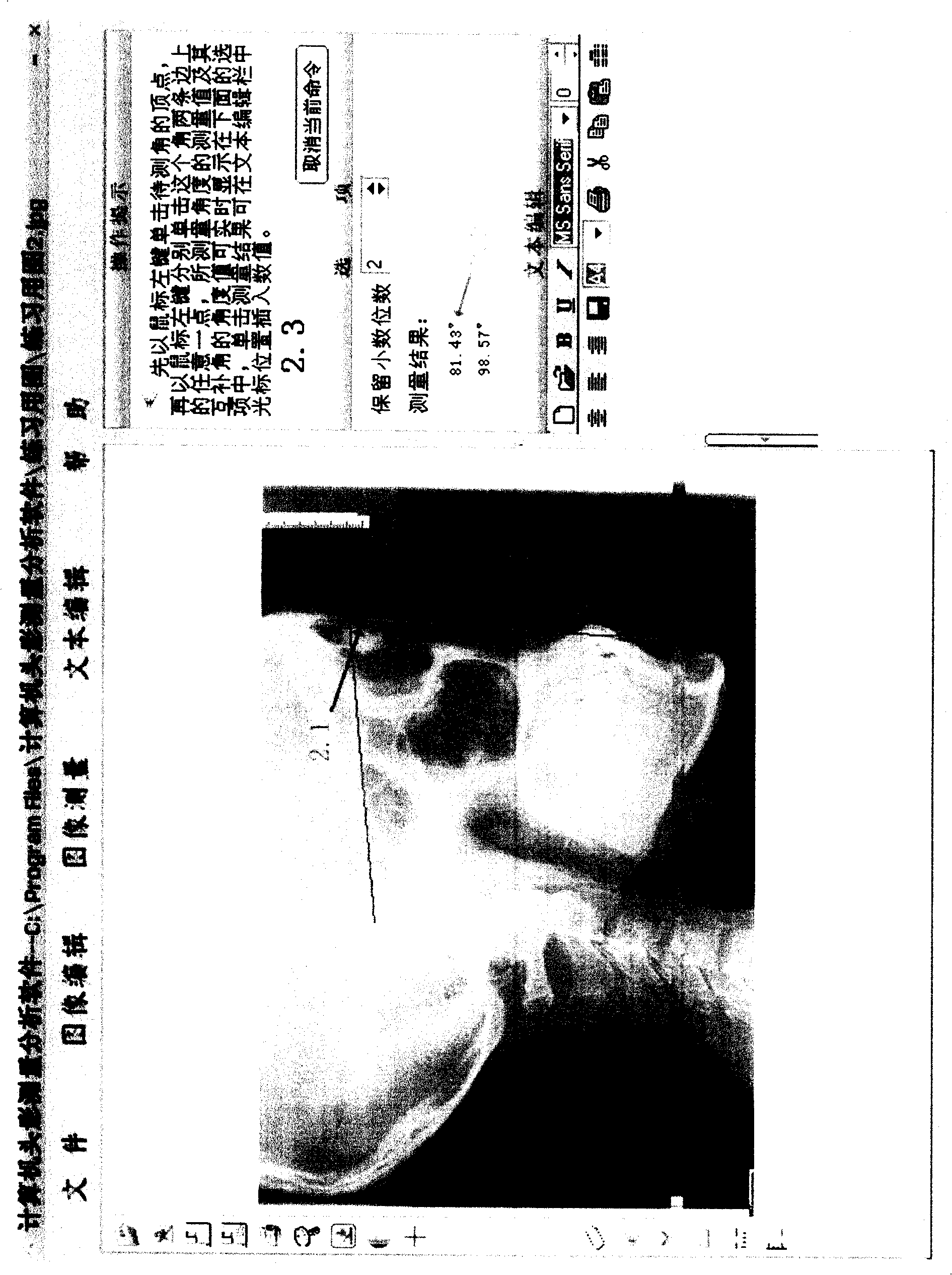 Method for measuring craniojaw skeleton. relationship and dimension