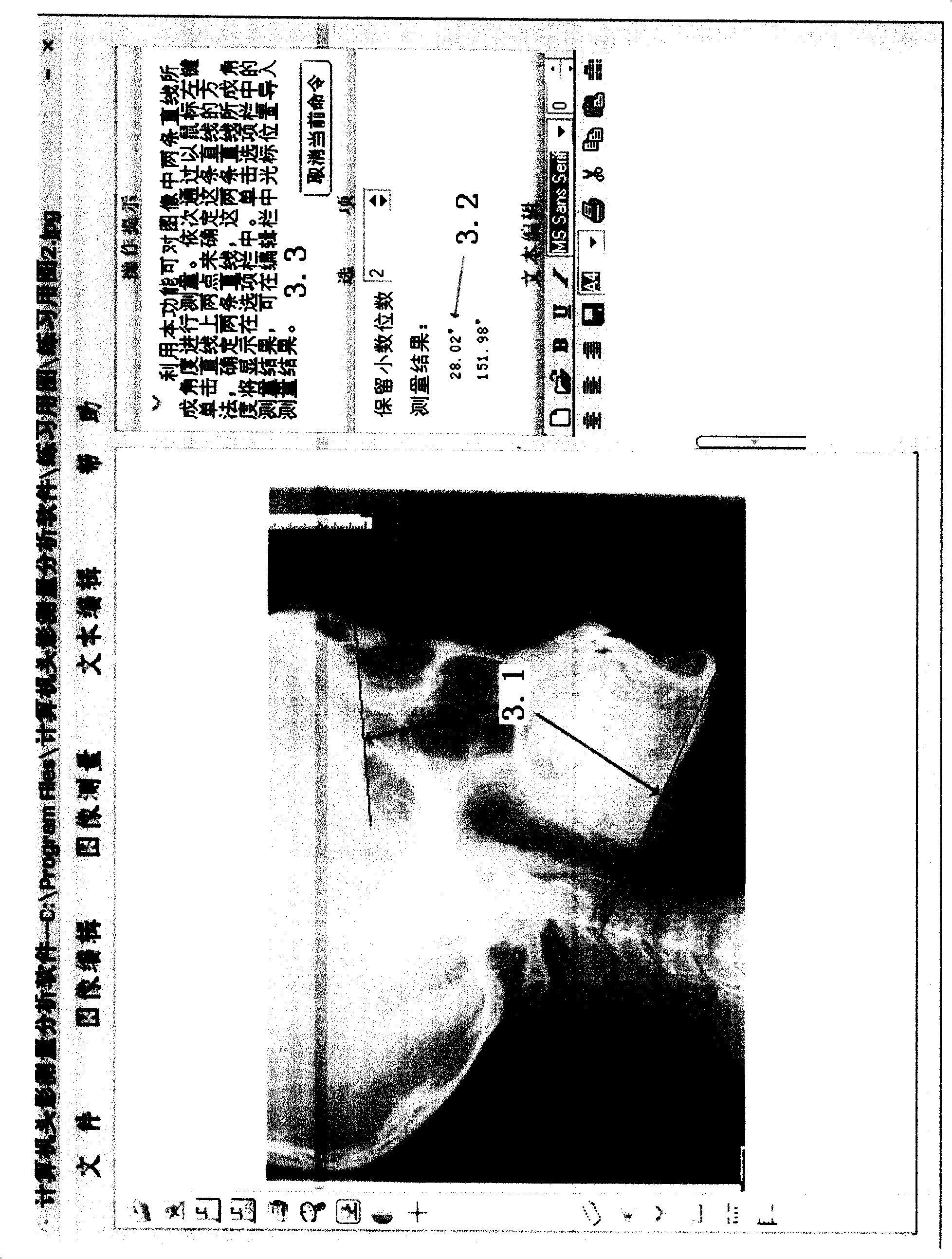 Method for measuring craniojaw skeleton. relationship and dimension