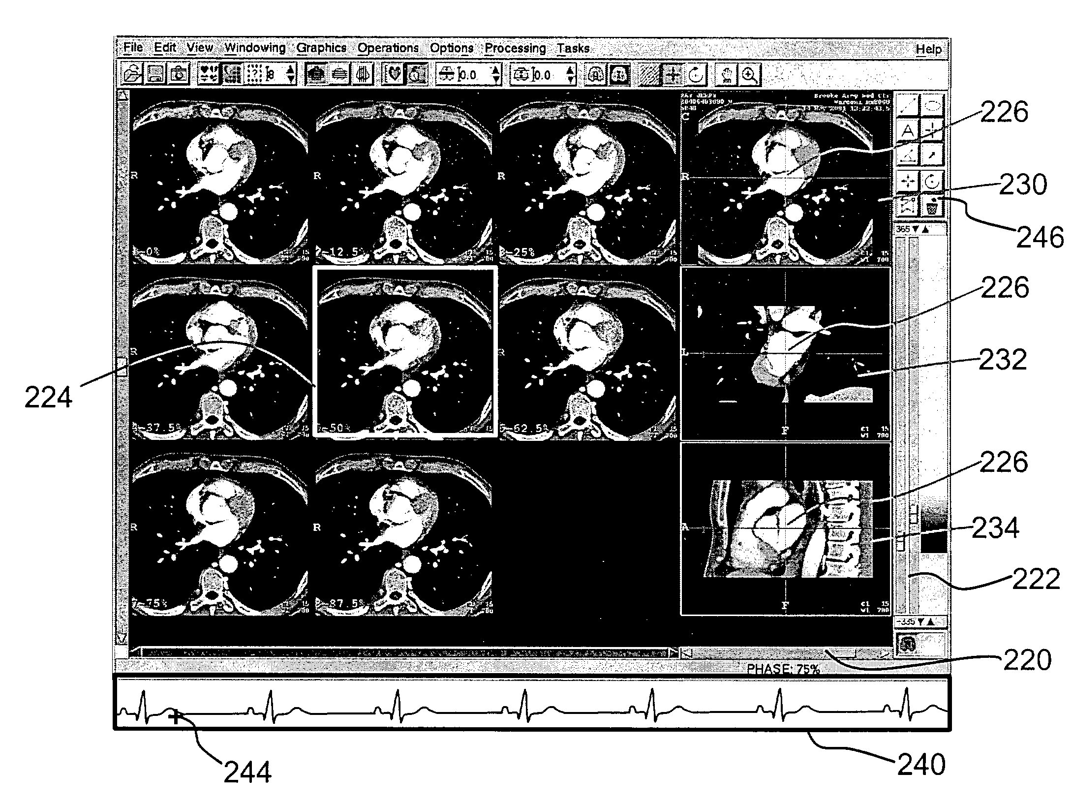 Method and apparatus for volumetric cardiac computed tomography imaging