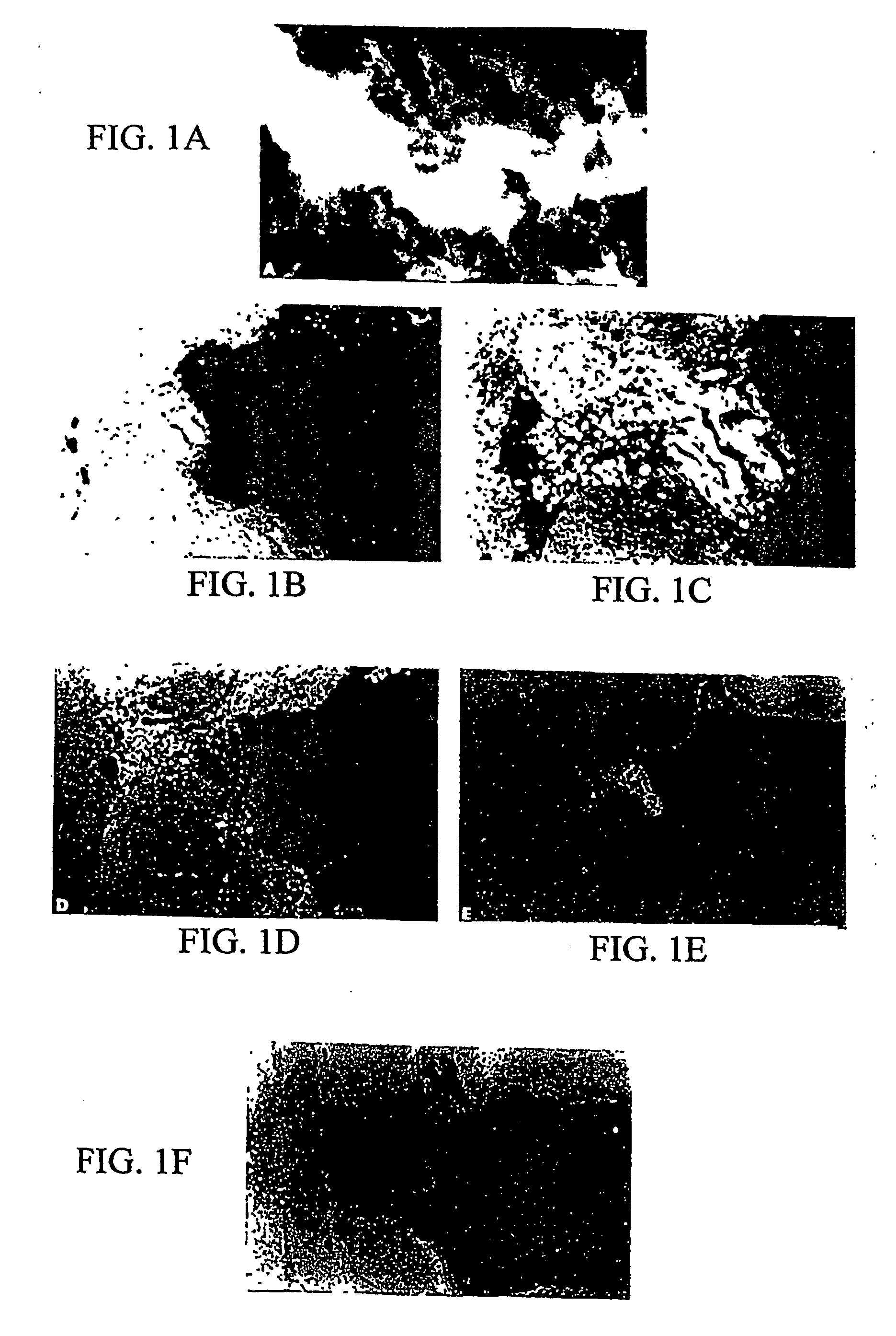 Methods for binding agents to b-amyloid plaques