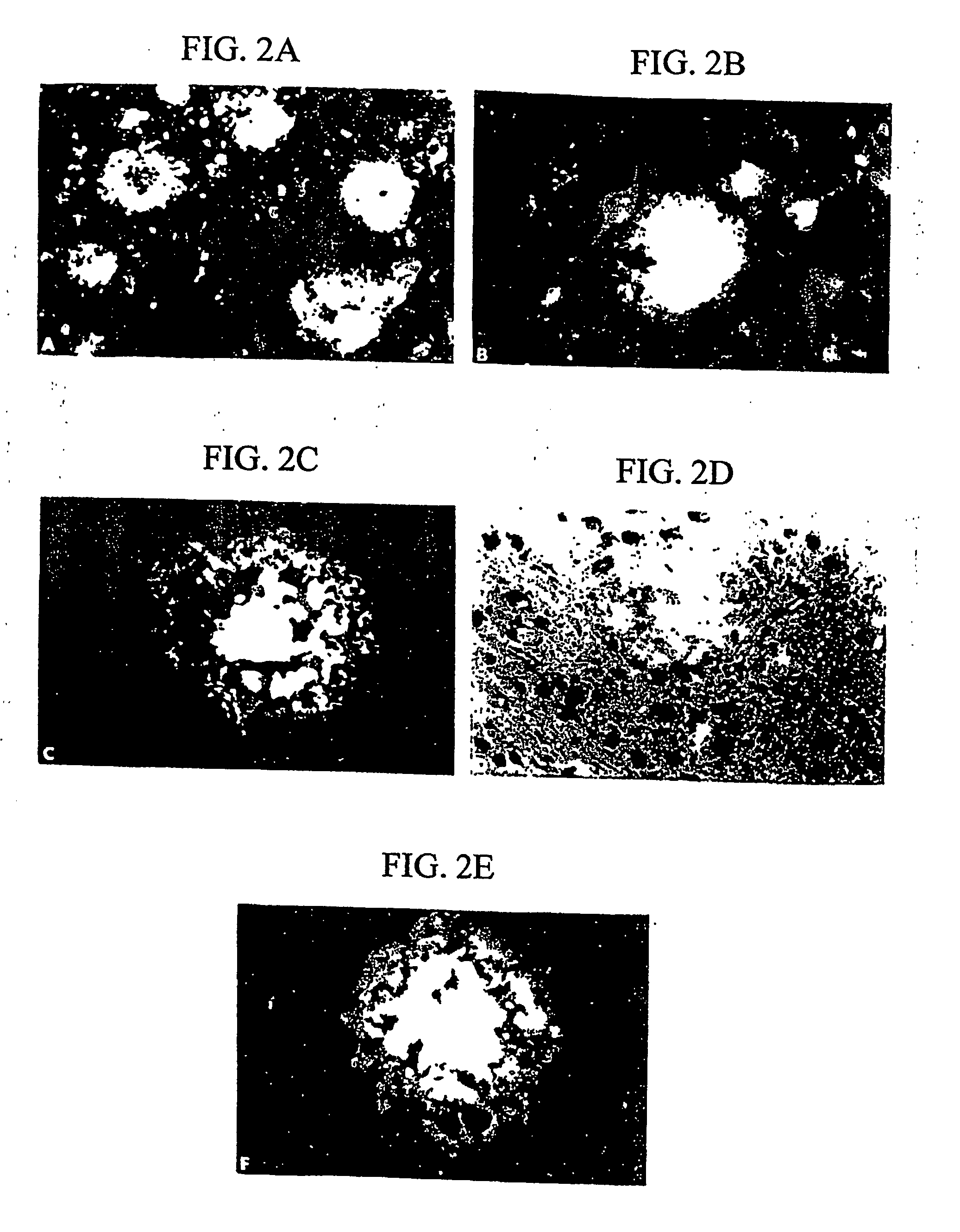 Methods for binding agents to b-amyloid plaques