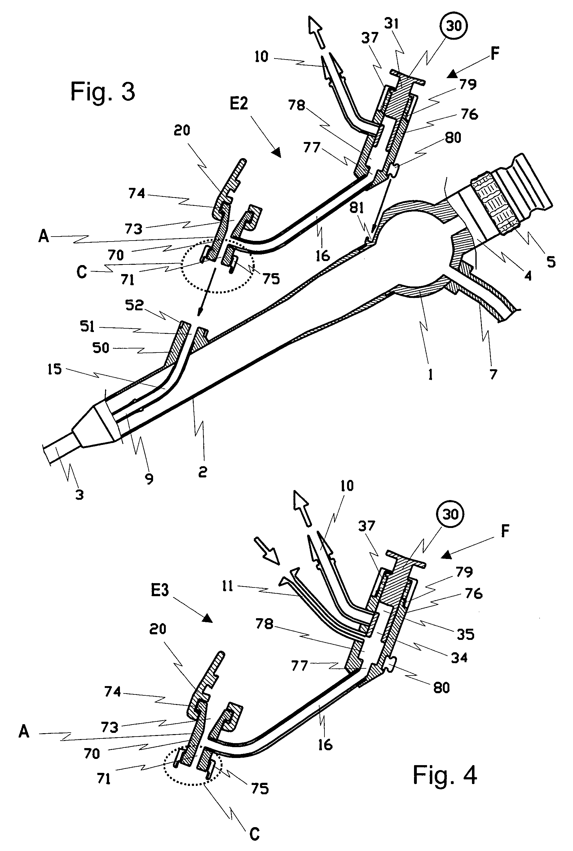 Removable operating device for a flexible endoscopic probe for medical purposes