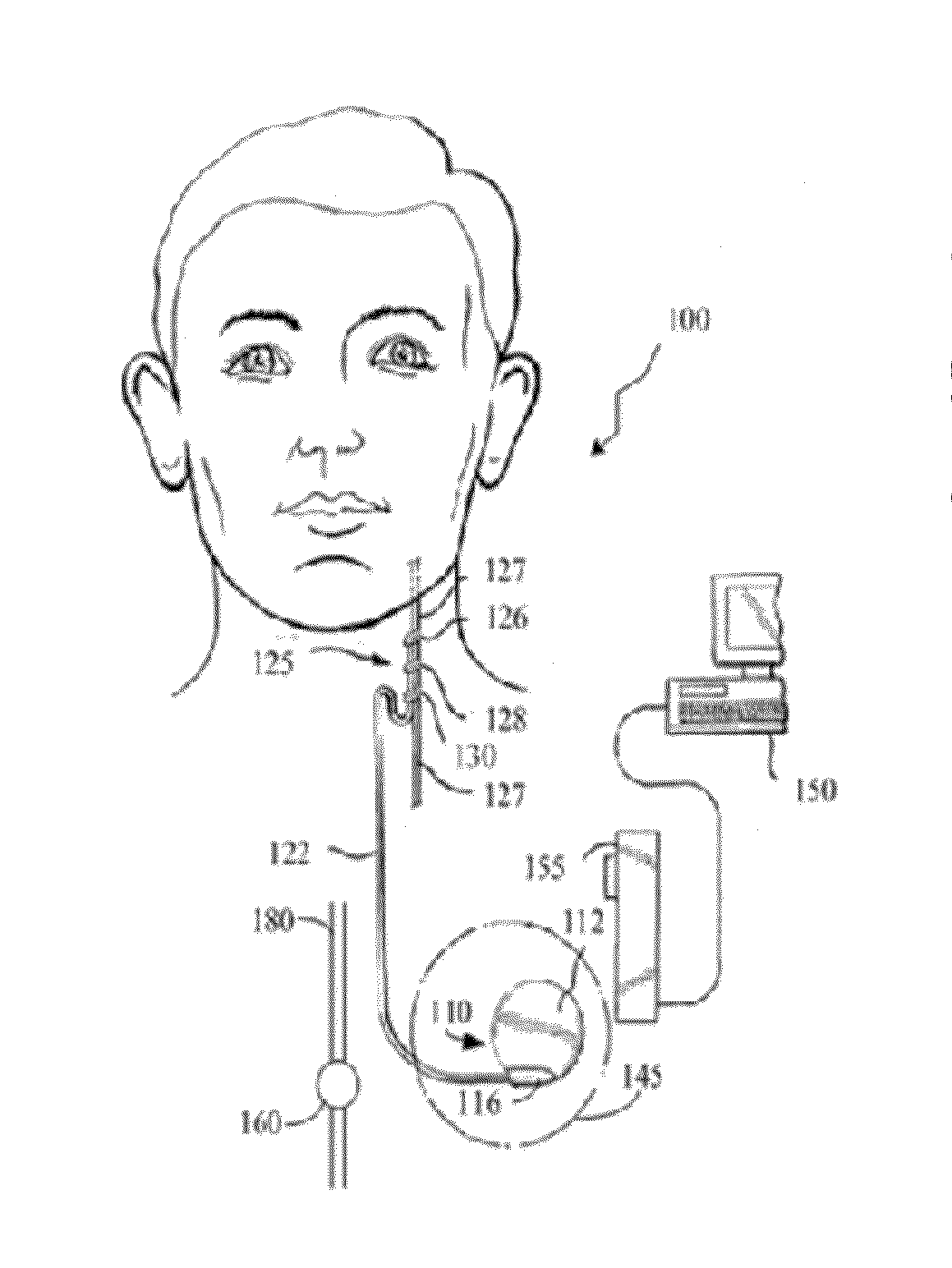 Detecting, assessing and managing extreme epileptic events