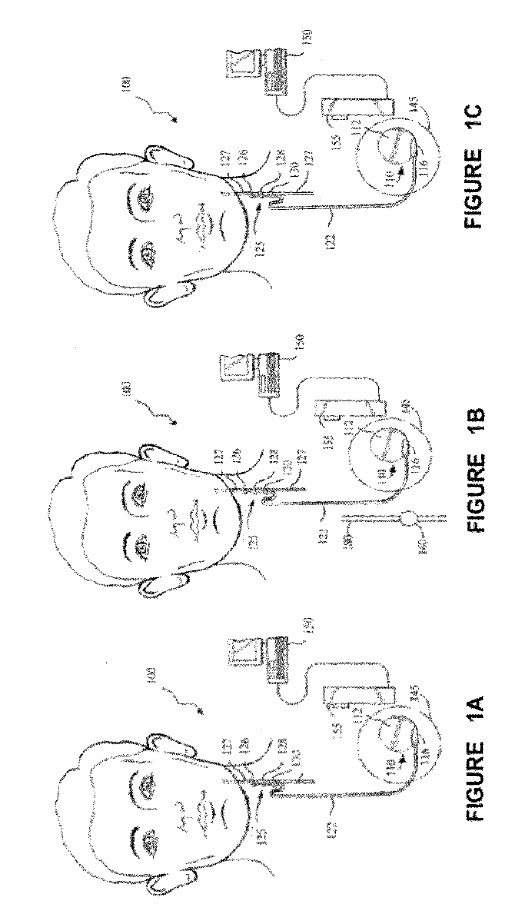 Detecting, assessing and managing extreme epileptic events