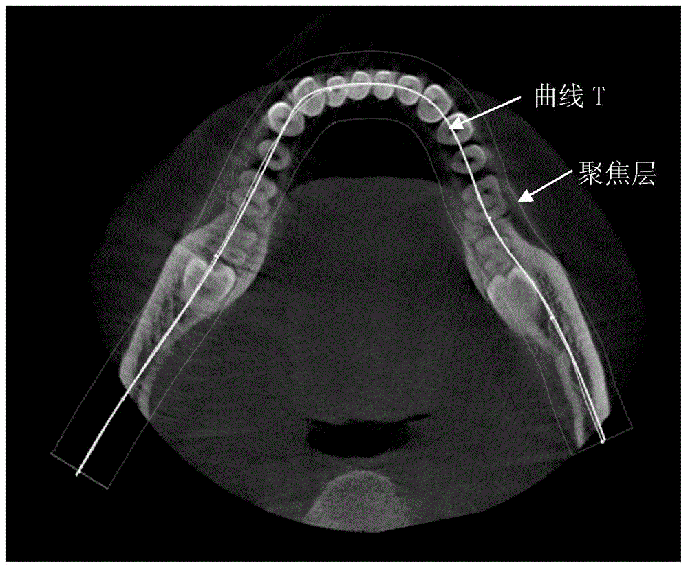 Method and apparatus for generating tooth panorama image, and panorama machine for shooting teeth