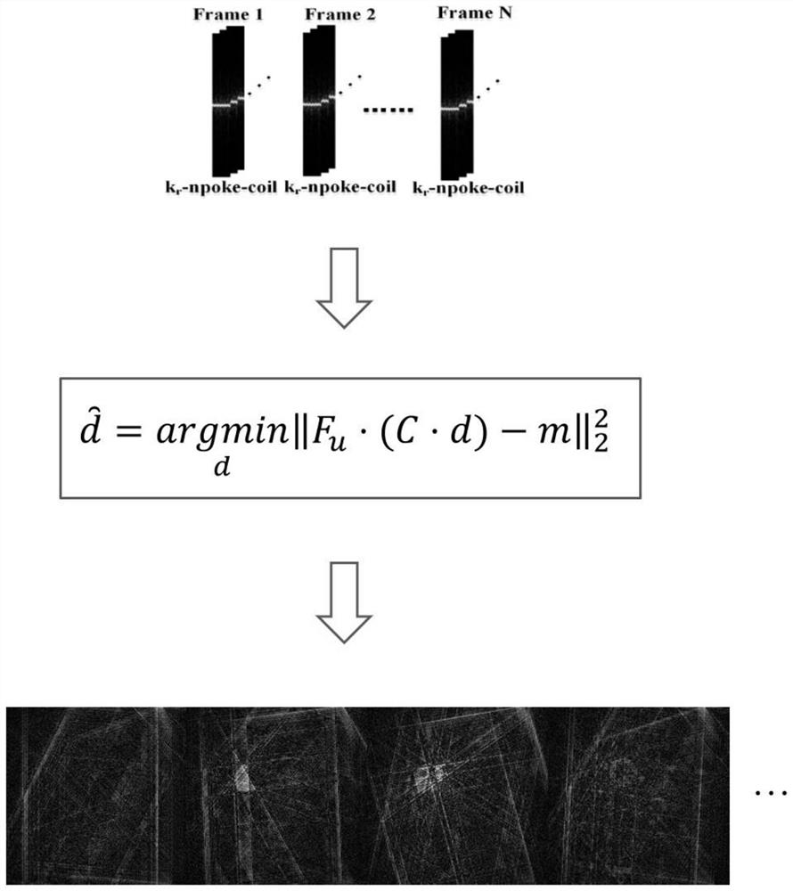 VBM3d-based magnetic resonance image reconstruction method