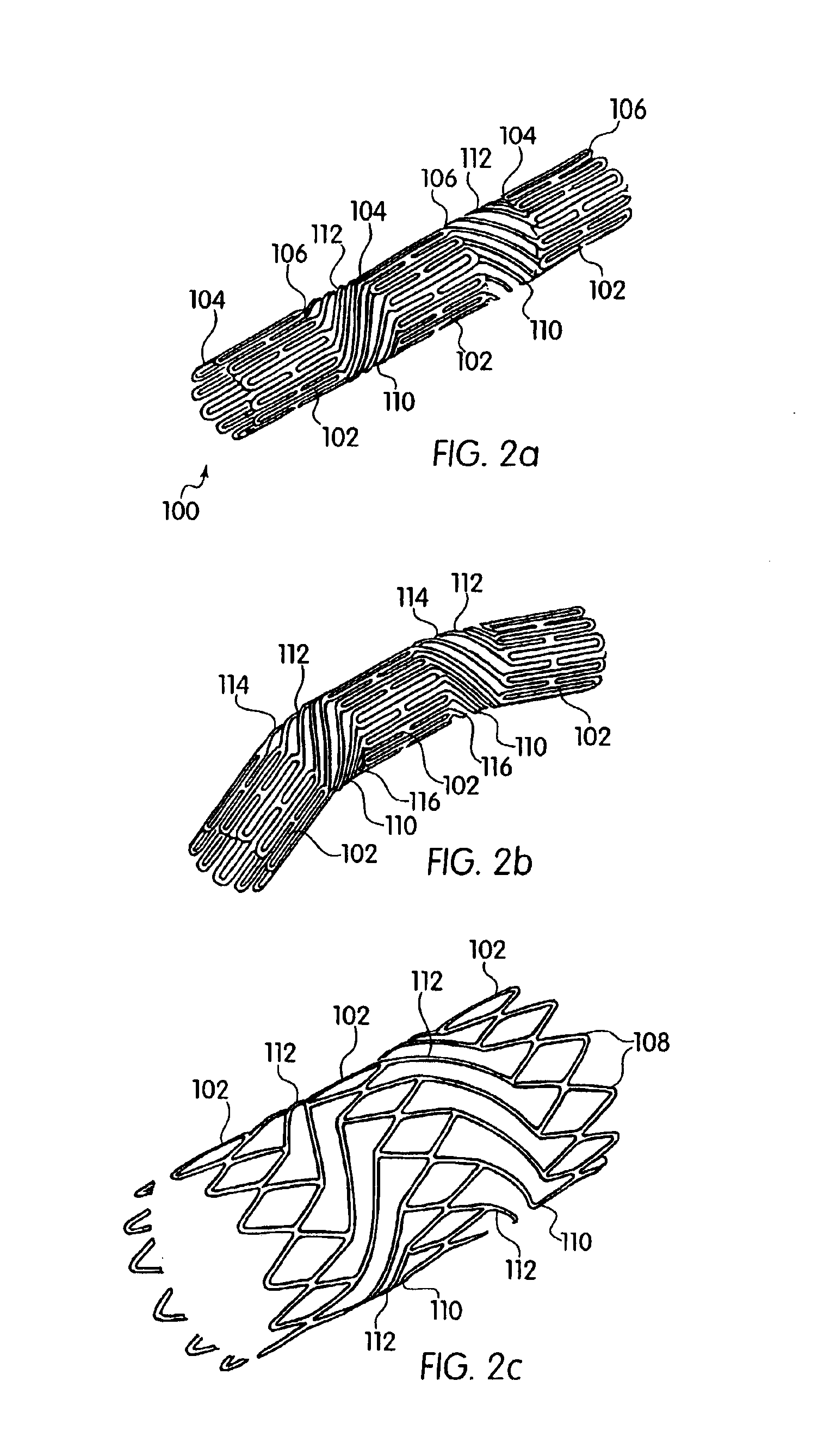 Articulated stent