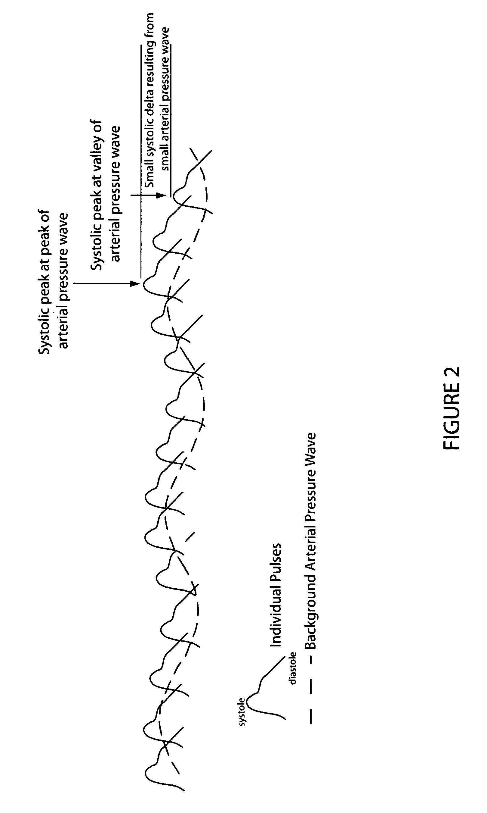 Method and system for assessing breathing effectiveness via assessment of the dynamic arterial pressure wave using the oscillometric measurement technique