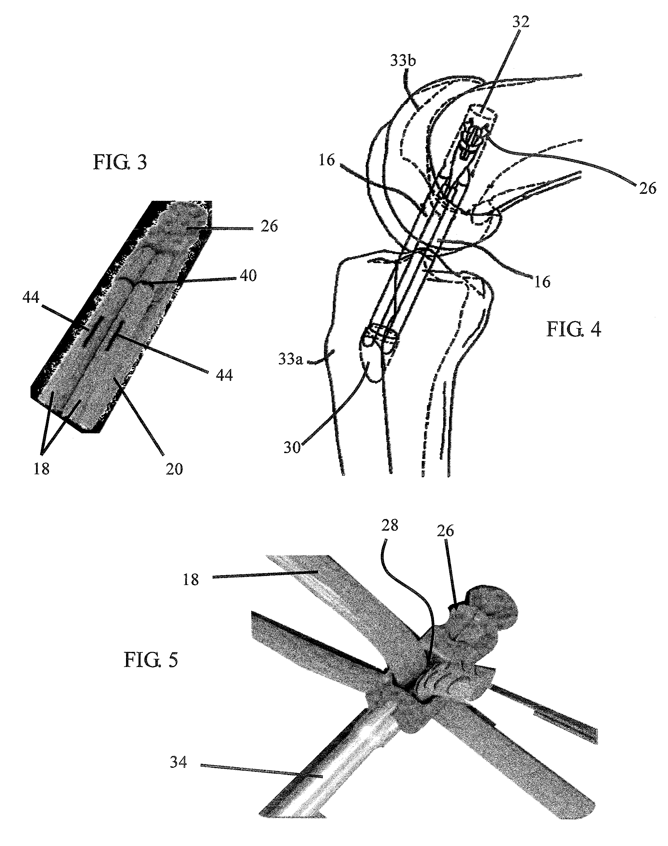 Method for surgically repairing a damaged ligament