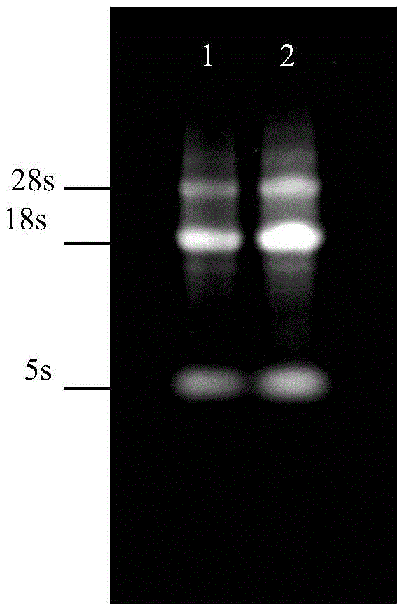 A kind of carboxylesterase gene dsrna and its application in the prevention and treatment of the wheat aphid