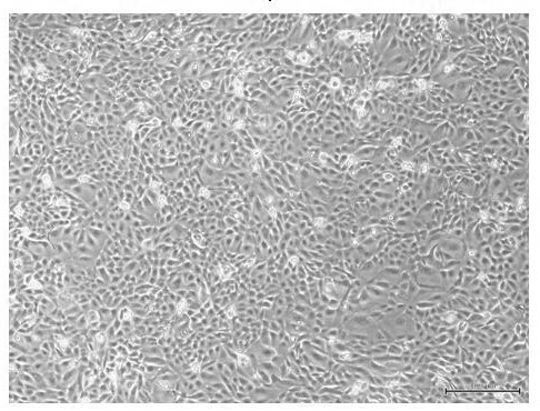 Human amniotic epithelial stem cell serum-free medium and culture method thereof