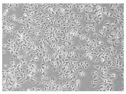 Human amniotic epithelial stem cell serum-free medium and culture method thereof