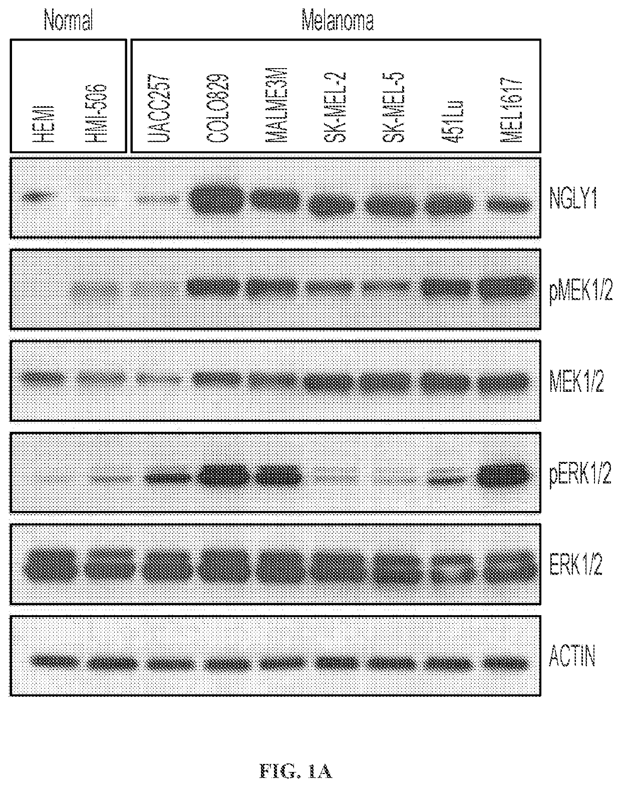 Inhibition of ngly1 for the treatment of cancer