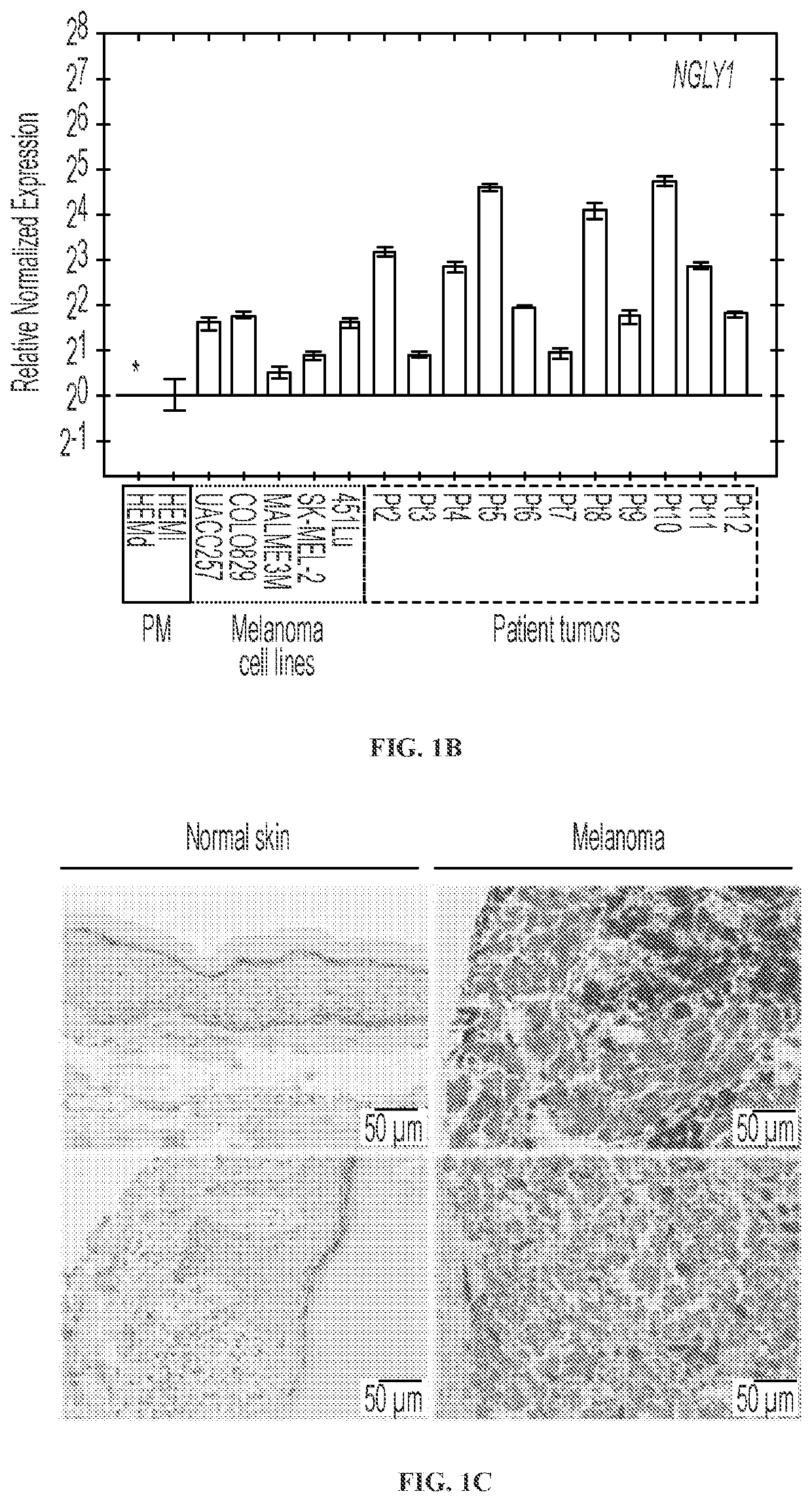 Inhibition of ngly1 for the treatment of cancer