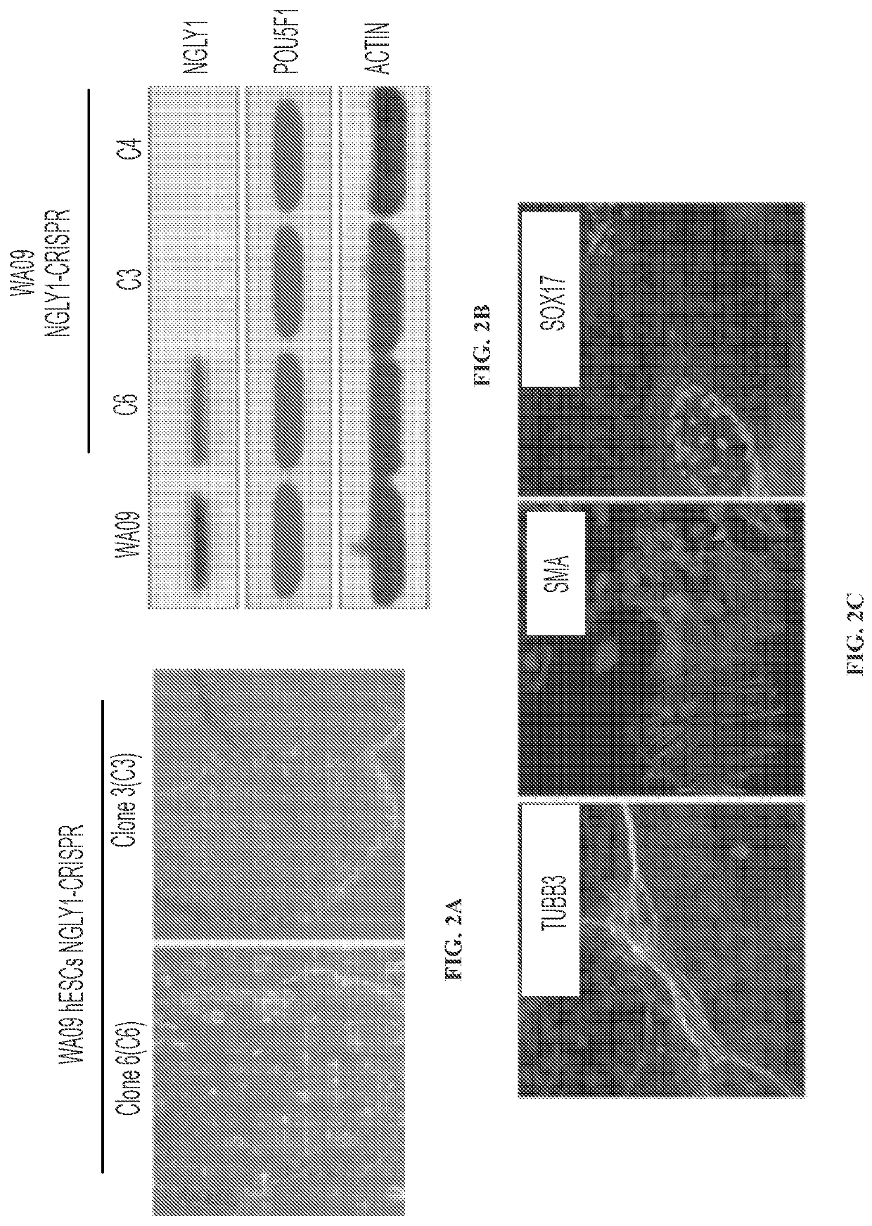 Inhibition of ngly1 for the treatment of cancer