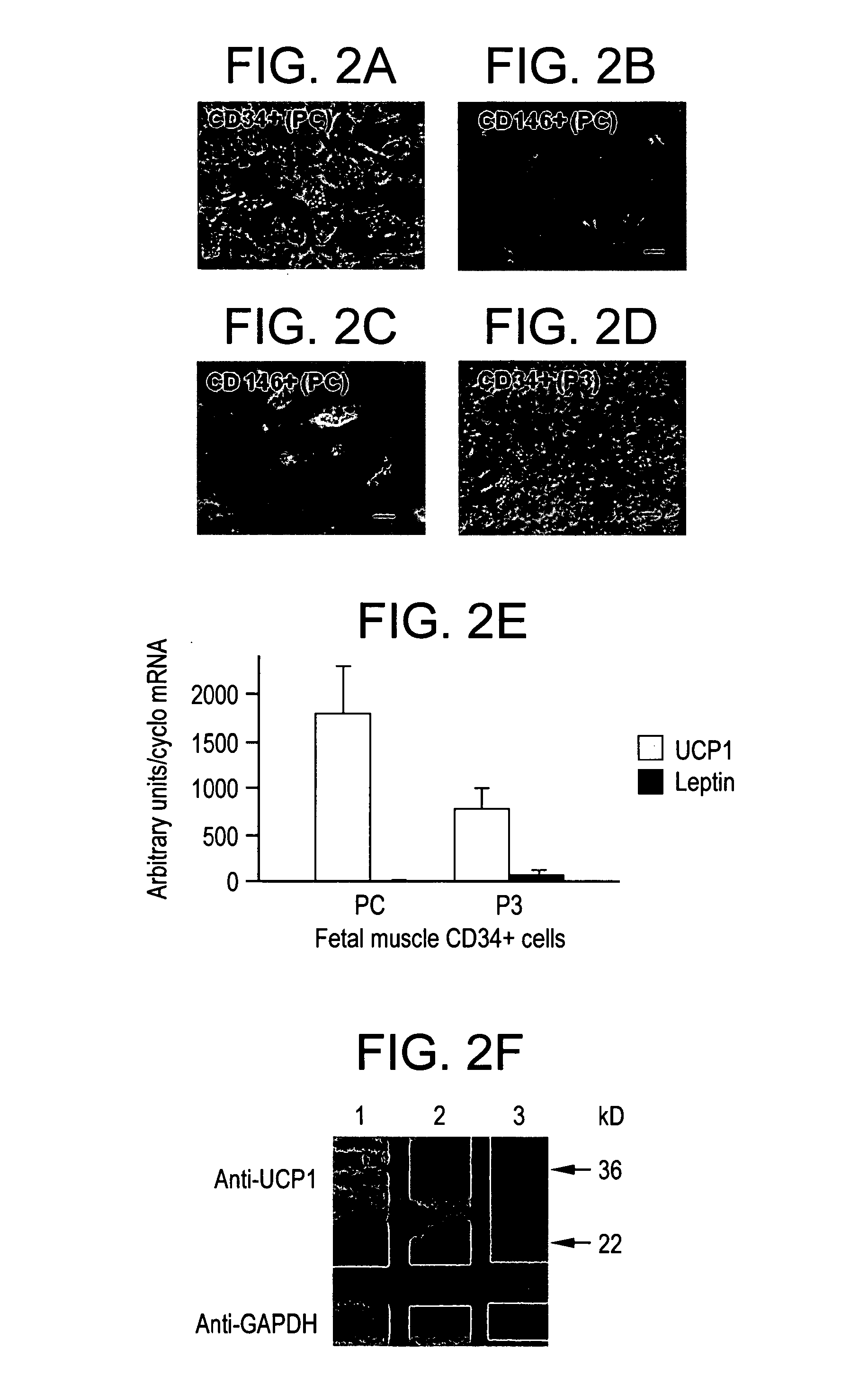 Brown Adipocyte Progenitors in Human Skeletal Muscle