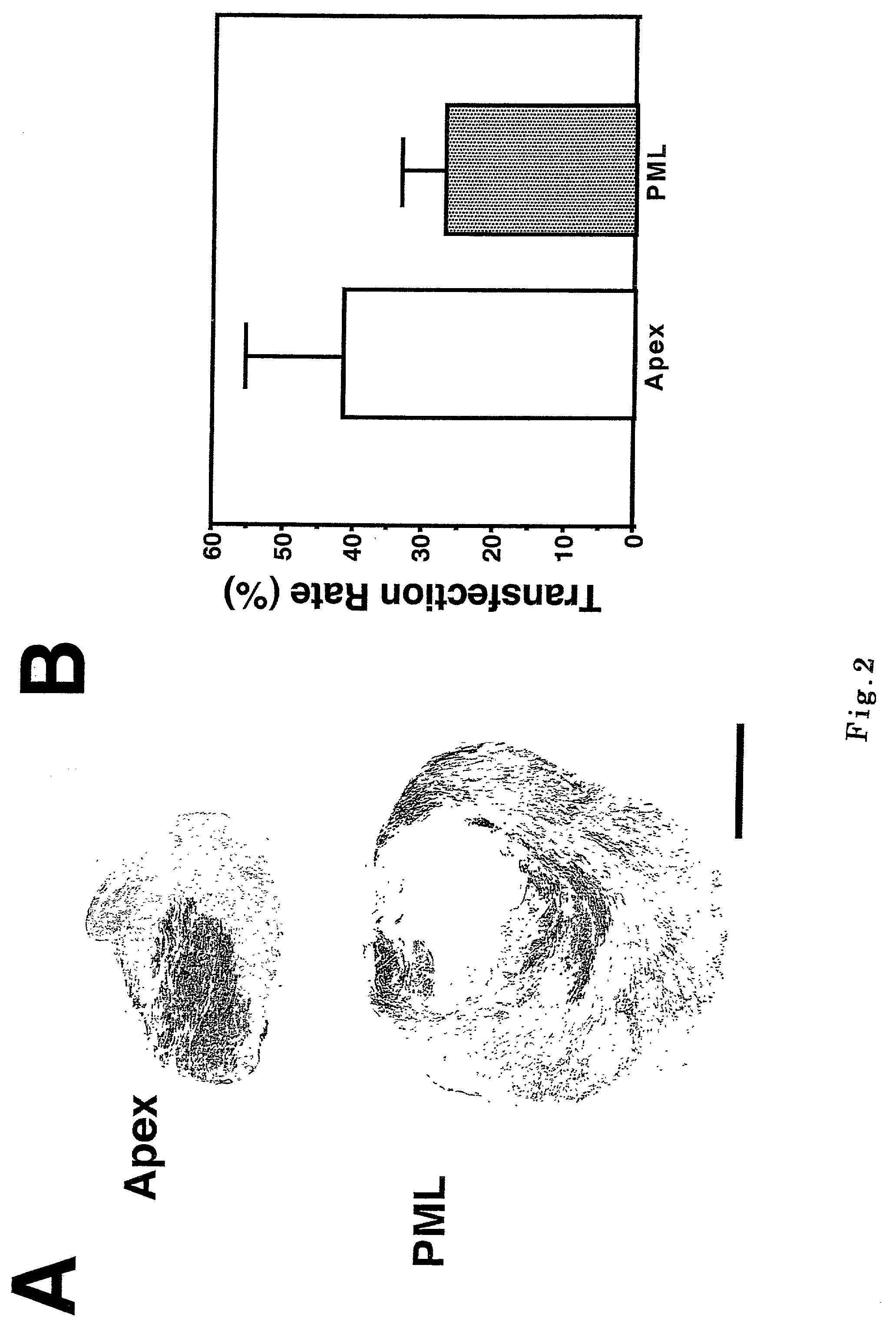 Agent for gene therapy of dilated cardomyopathy