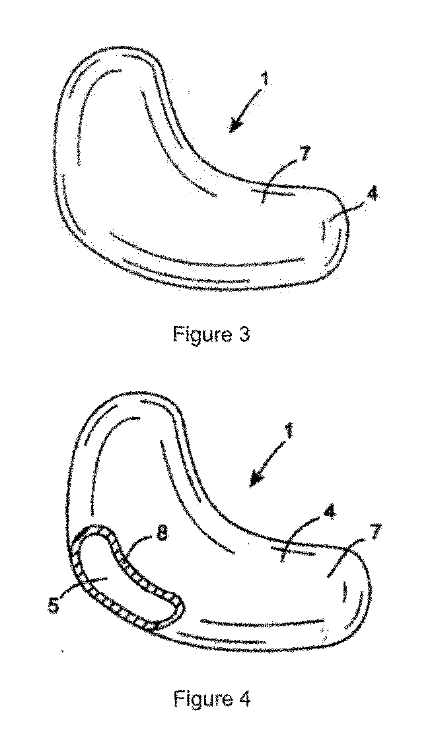 Apparatus for stimulating a reflexology point on a foot of a subject