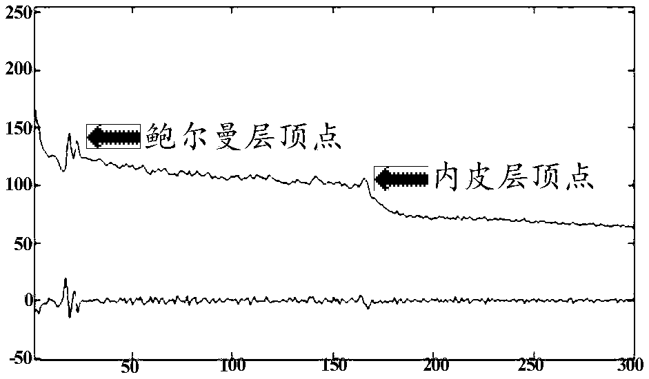 Method and system for segmenting cornea structure from OCT (Optical Coherence Tomography) cornea image