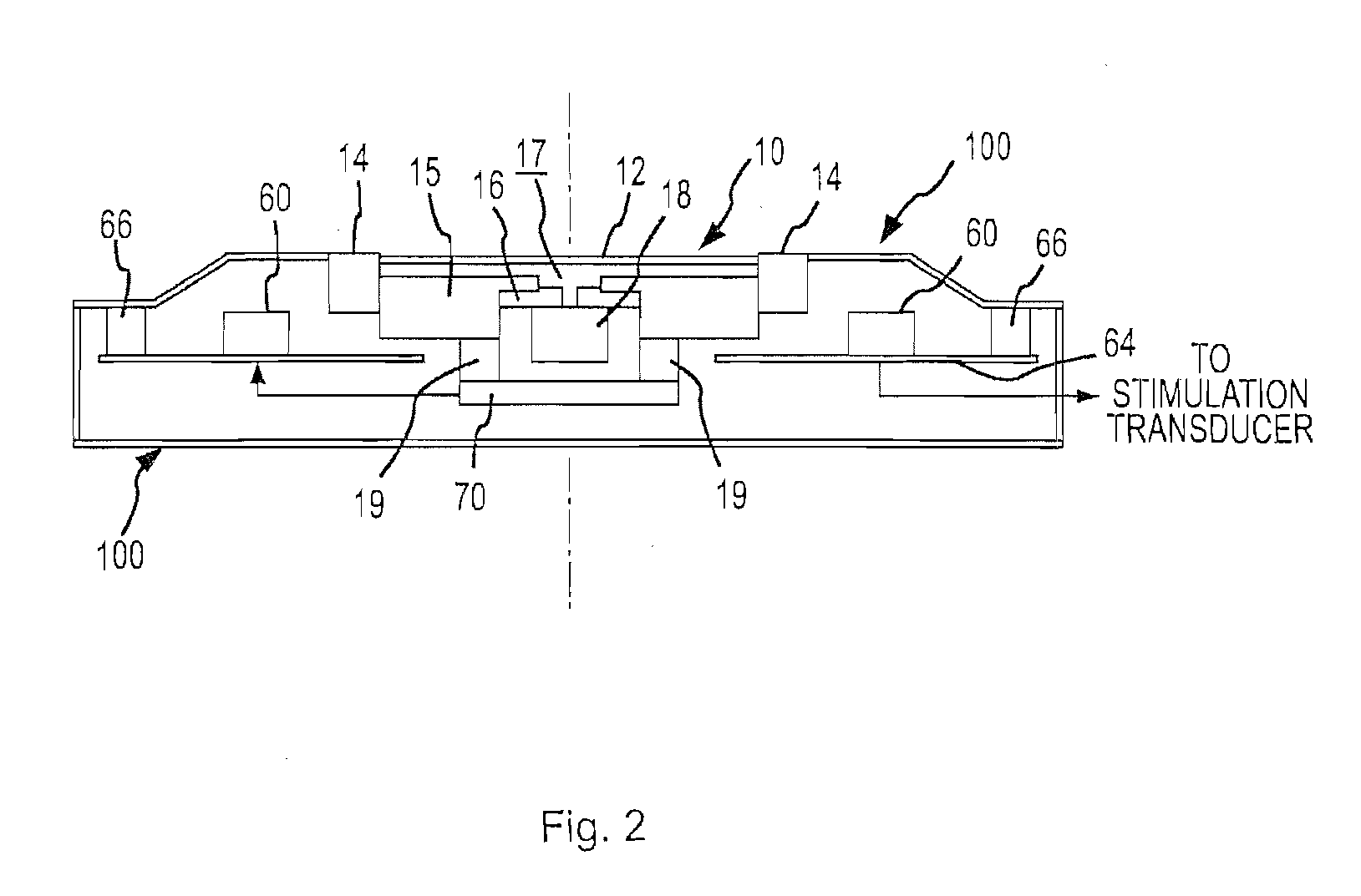 Adaptive cancellation system for implantable hearing instruments