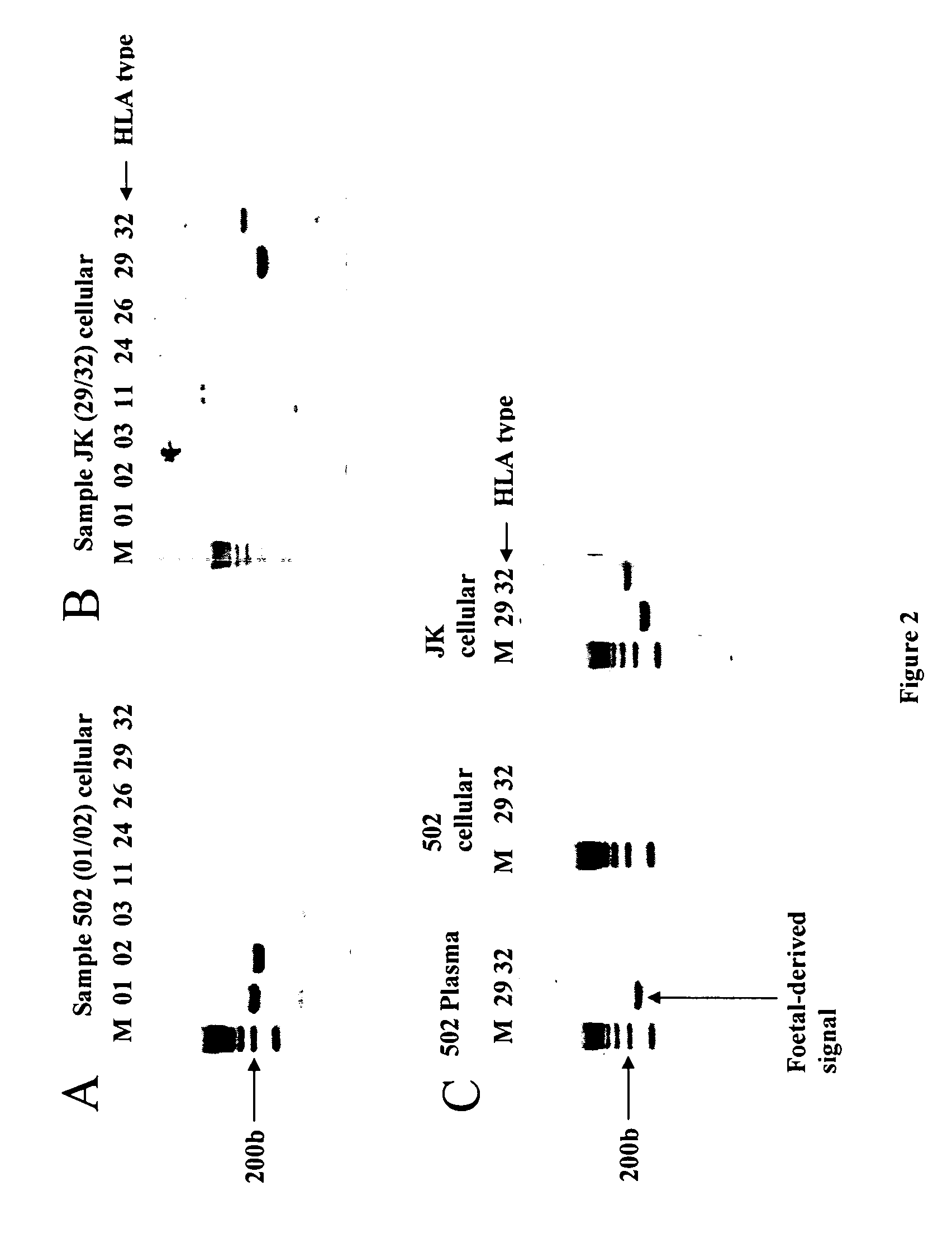 Identification of fetal dna and fetal cell markers in maternal plasma or serum
