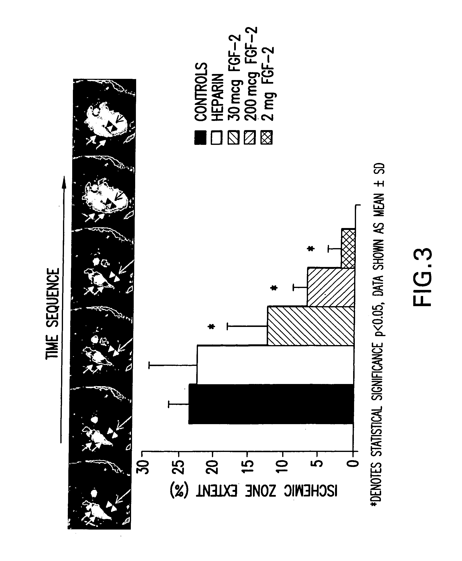 Methods of use of fibroblast growth factor, vascular endothelial growth factor and related proteins in the treatment of acute and chronic heart disease