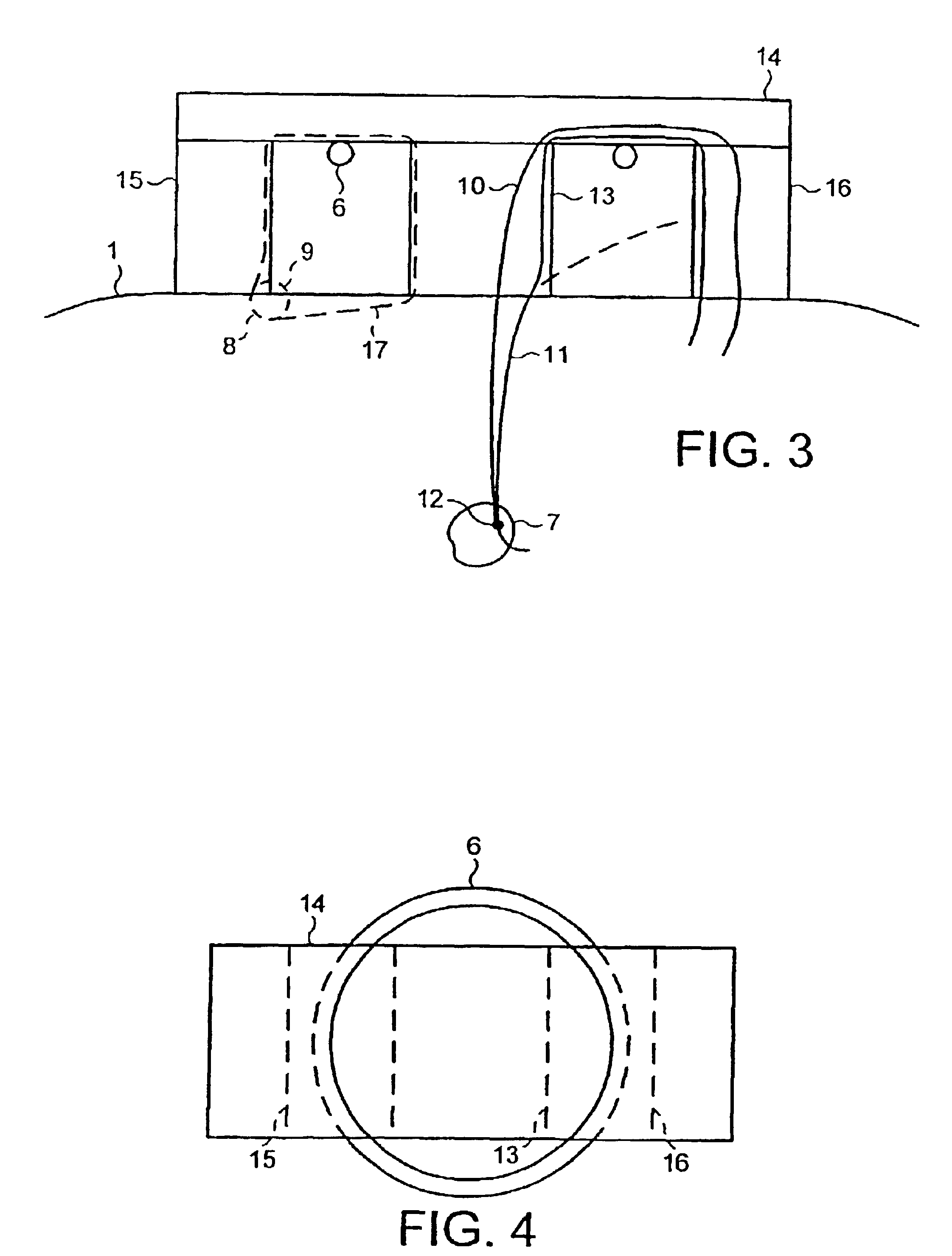 Magnetic resonance apparatus including an rf magnetic flux guiding structure for improving the signal-to-noise ratio