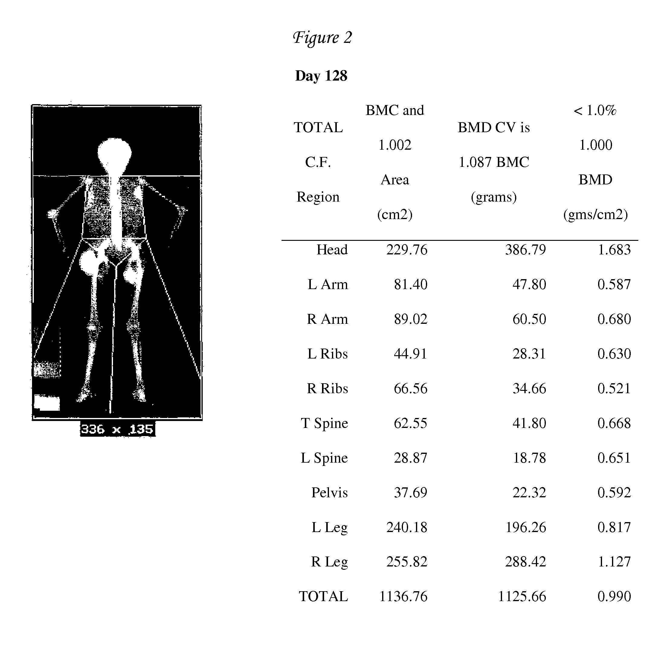 Peritoneal Dialysis Method