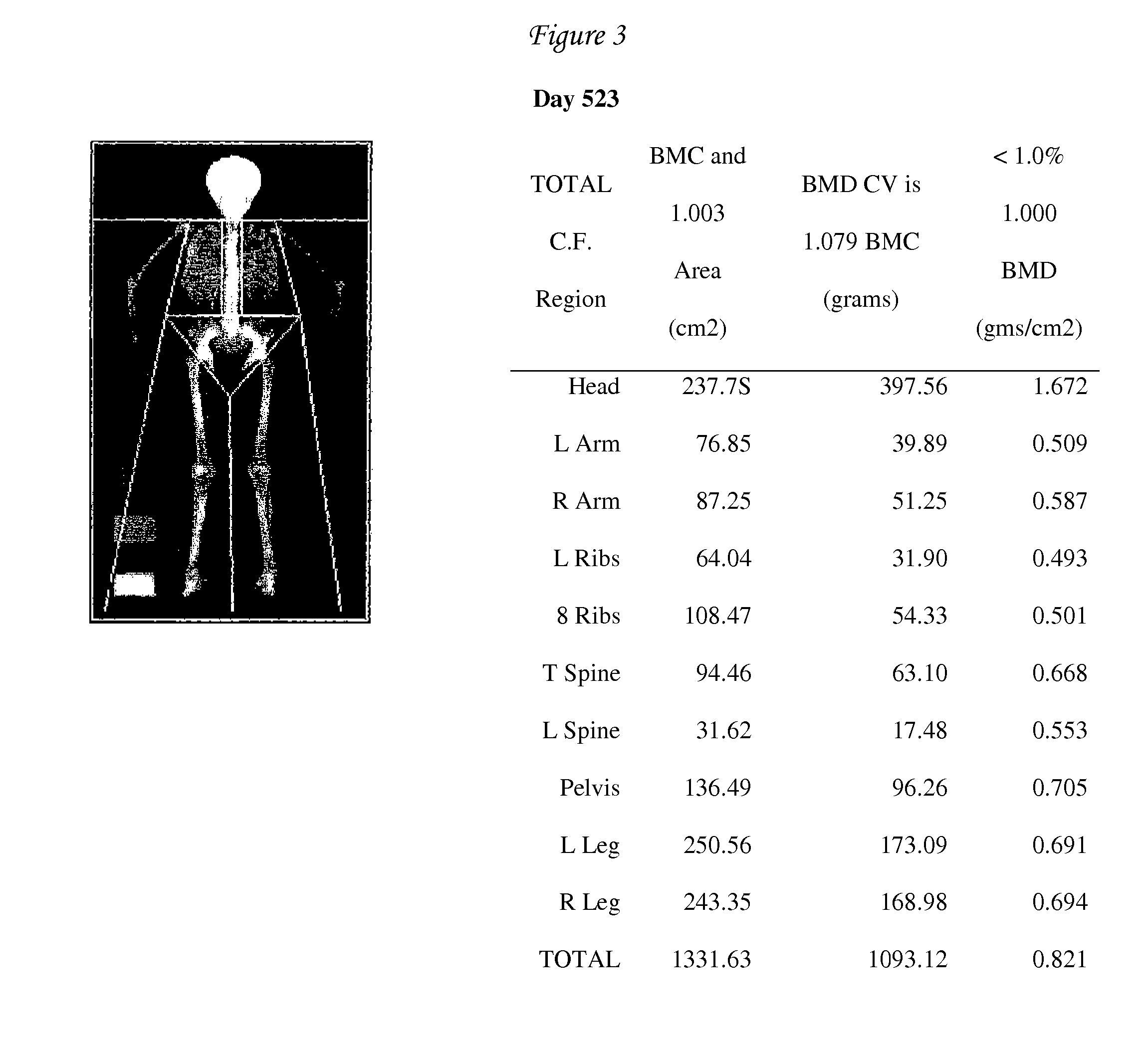 Peritoneal Dialysis Method