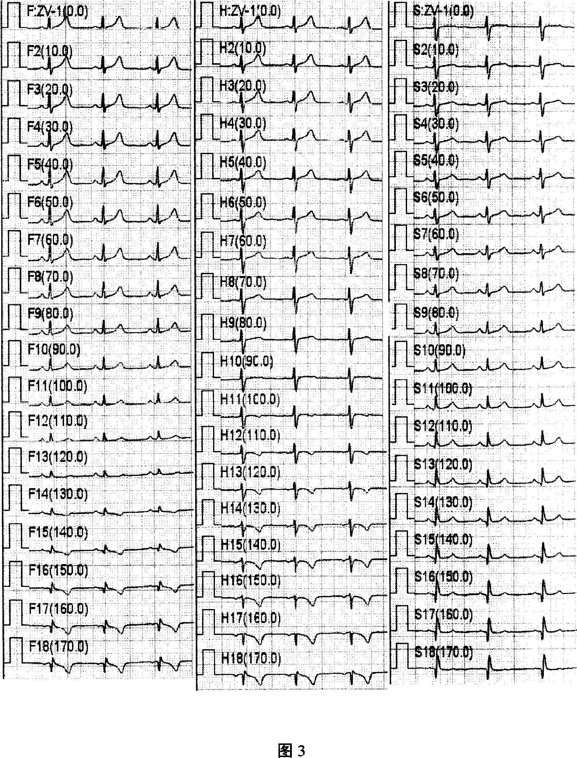 Vector ECG instrument and carrying out method thereof