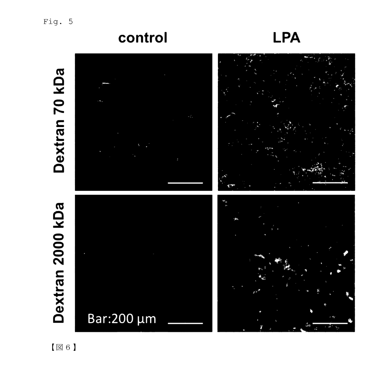 Drug delivery enhancer comprising substance for activating lysophospholipid receptors