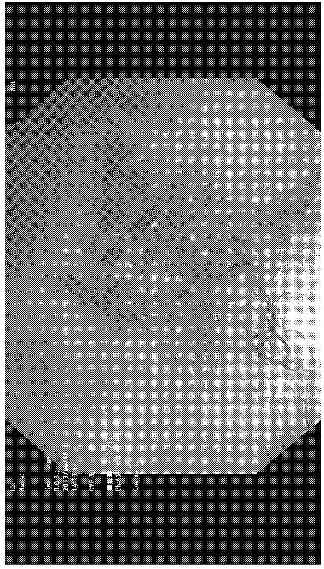 Therapeutic agent for lower urinary tract disease