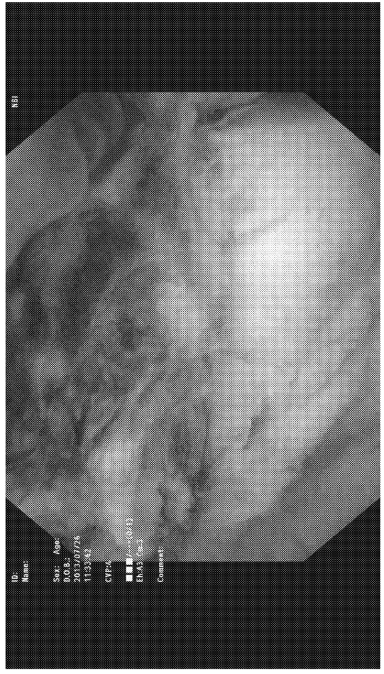 Therapeutic agent for lower urinary tract disease