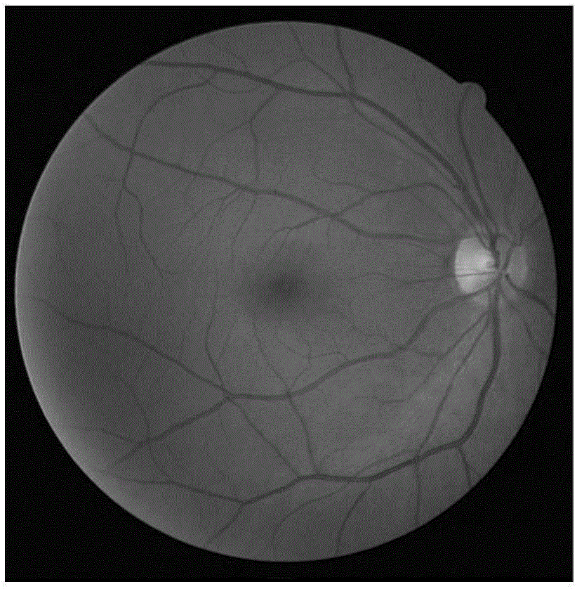 Dynamic scale distribution-based retinal vessel extraction method and system