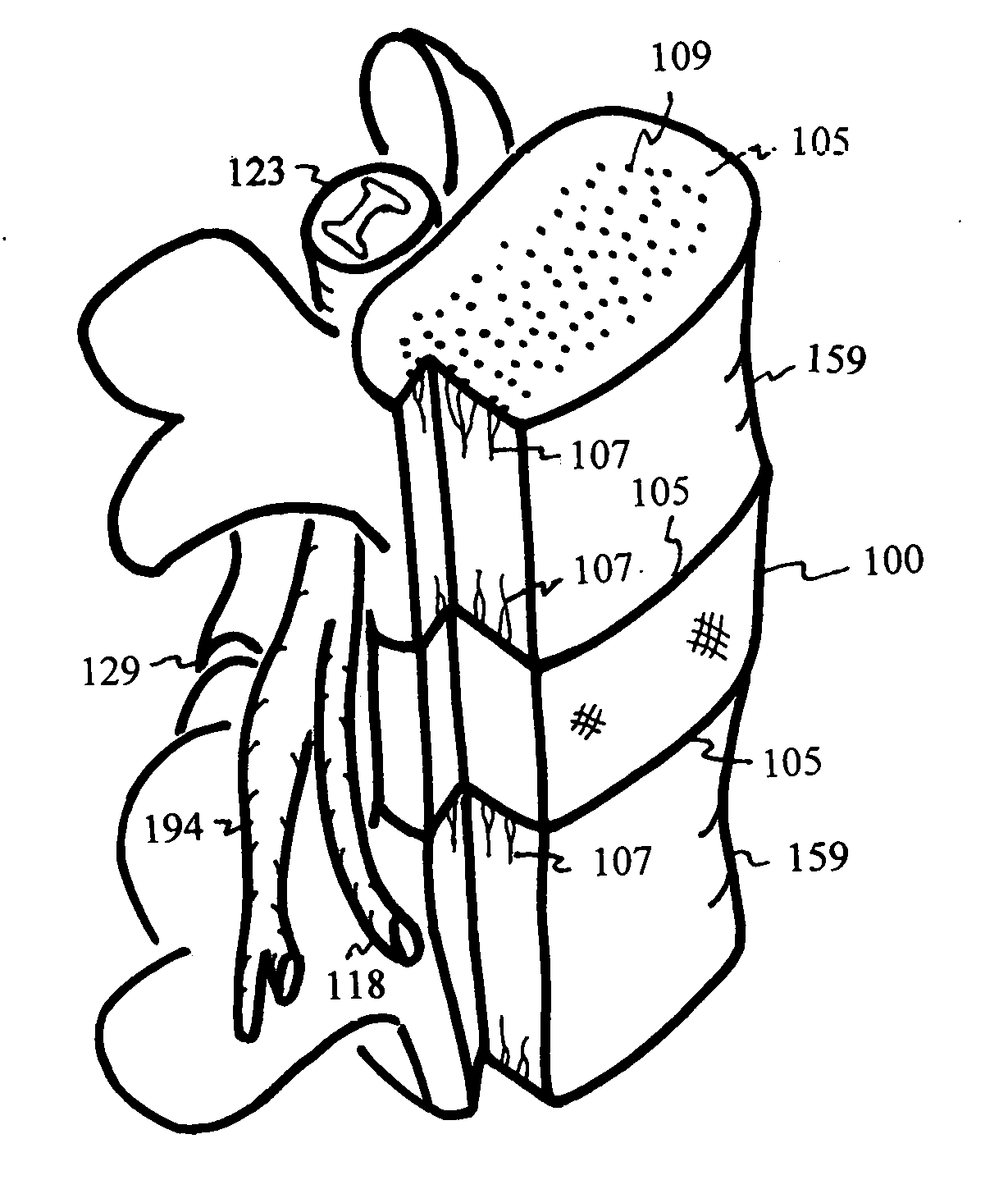 Method for relieving pain and regenerating intervertebral disc