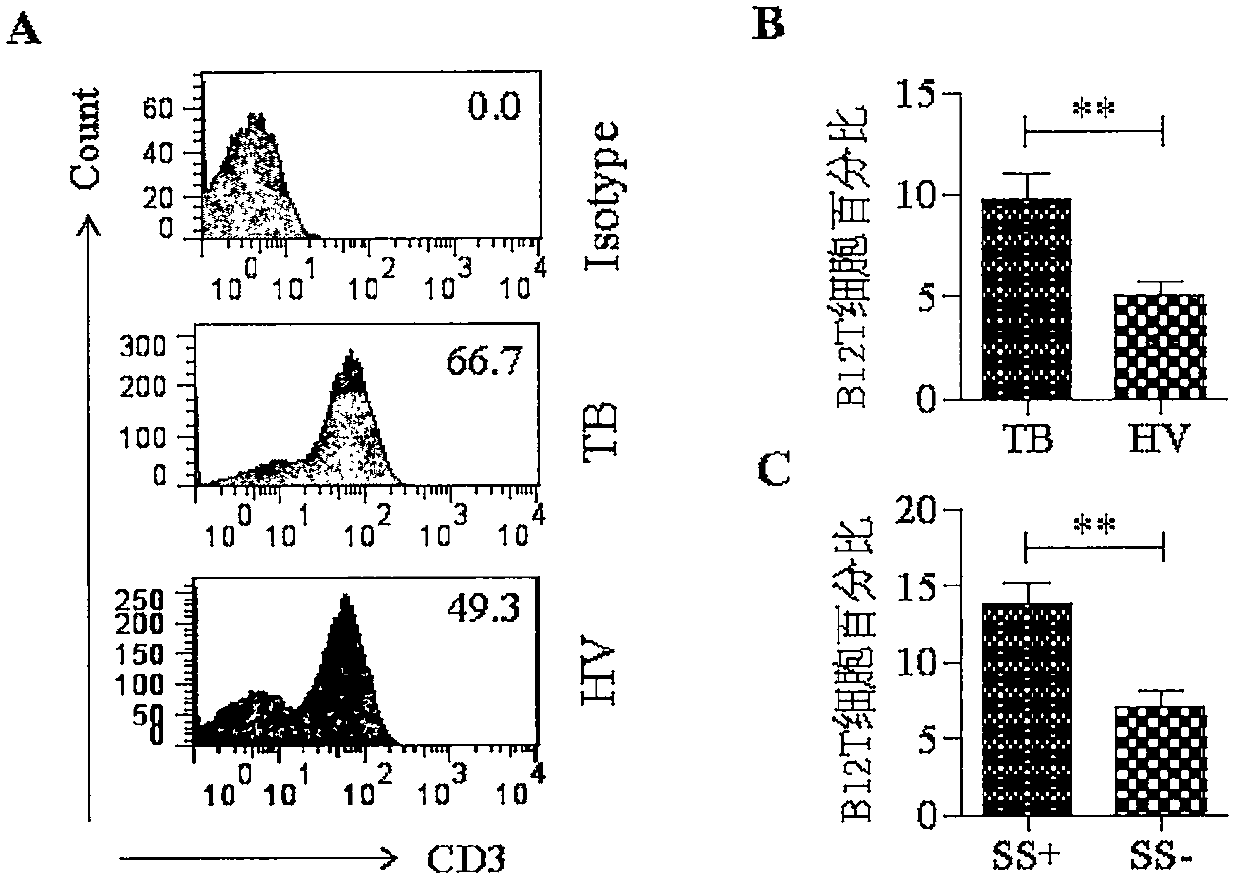 Inhibitor of b12 protein expression and its application in tuberculosis immunity and treatment