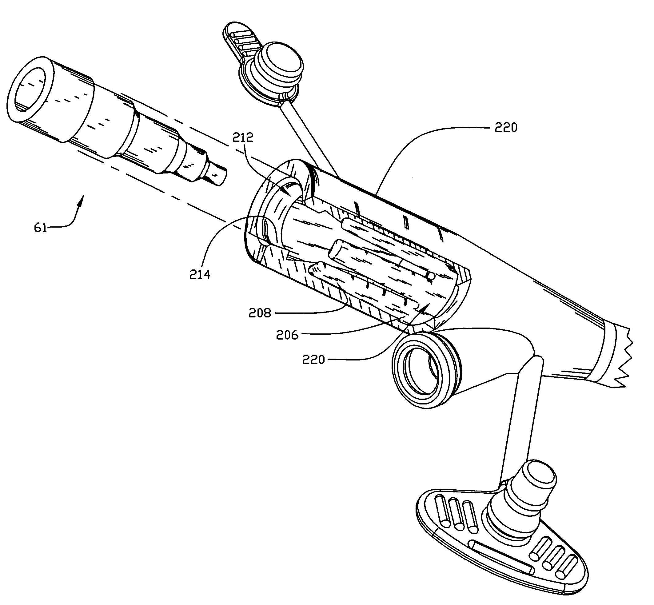 Retention device for medical components
