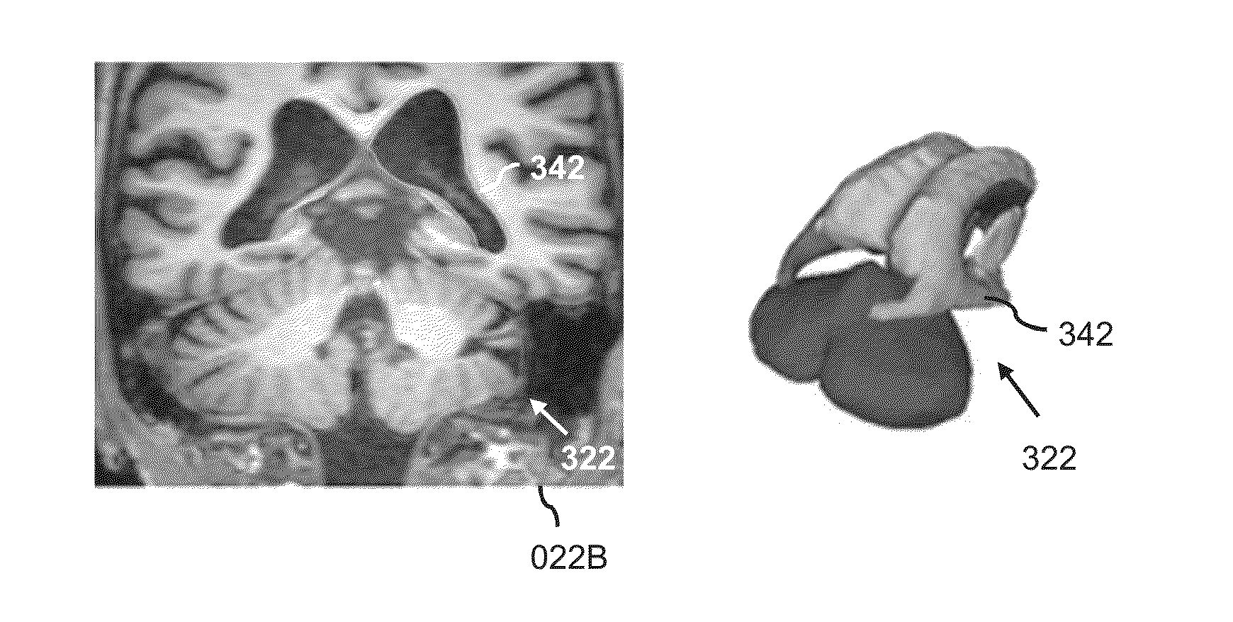 Model-based segmentation of an anatomical structure