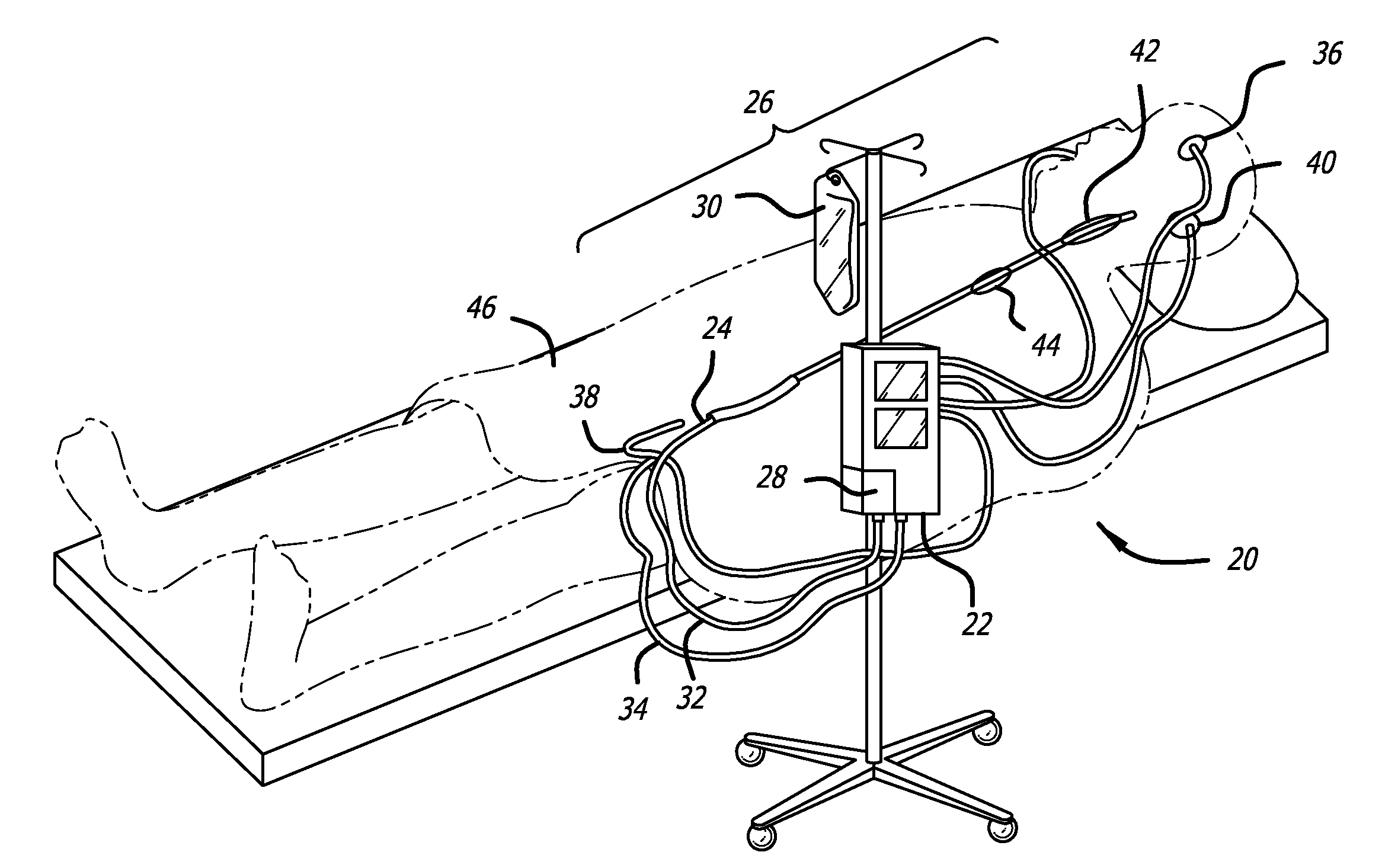 Apparatus and method for providing enhanced heat transfer from a body