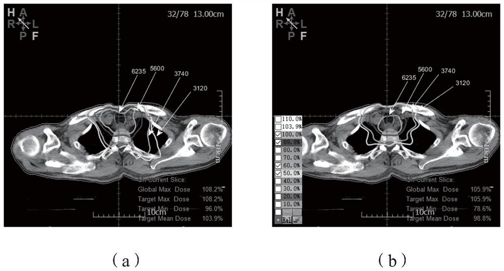 An optimal dose-guided TPS automatic iterative optimization method